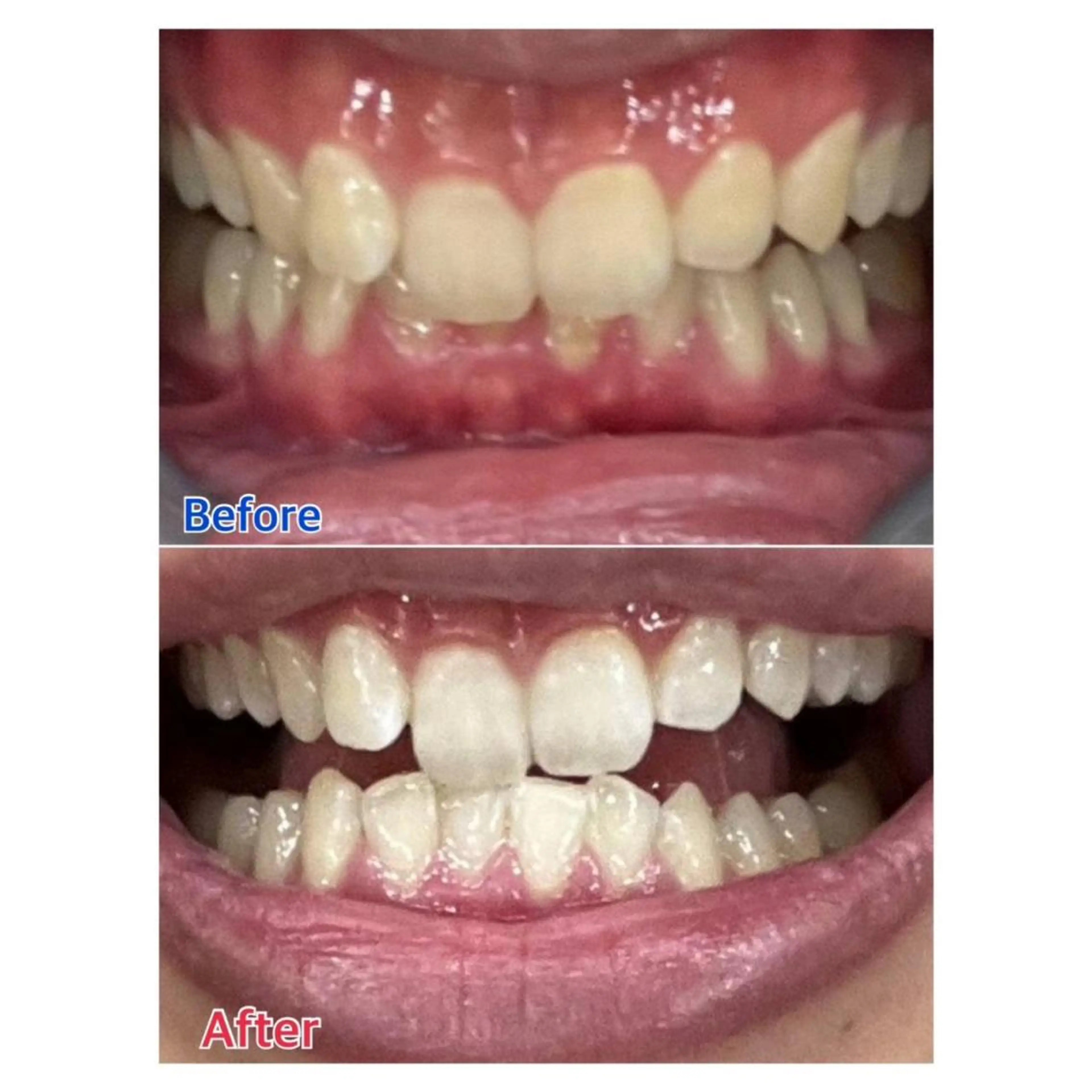 MBEAUTYSALON 千葉店・京成大久保所属・Melty 輝のその他イメージ