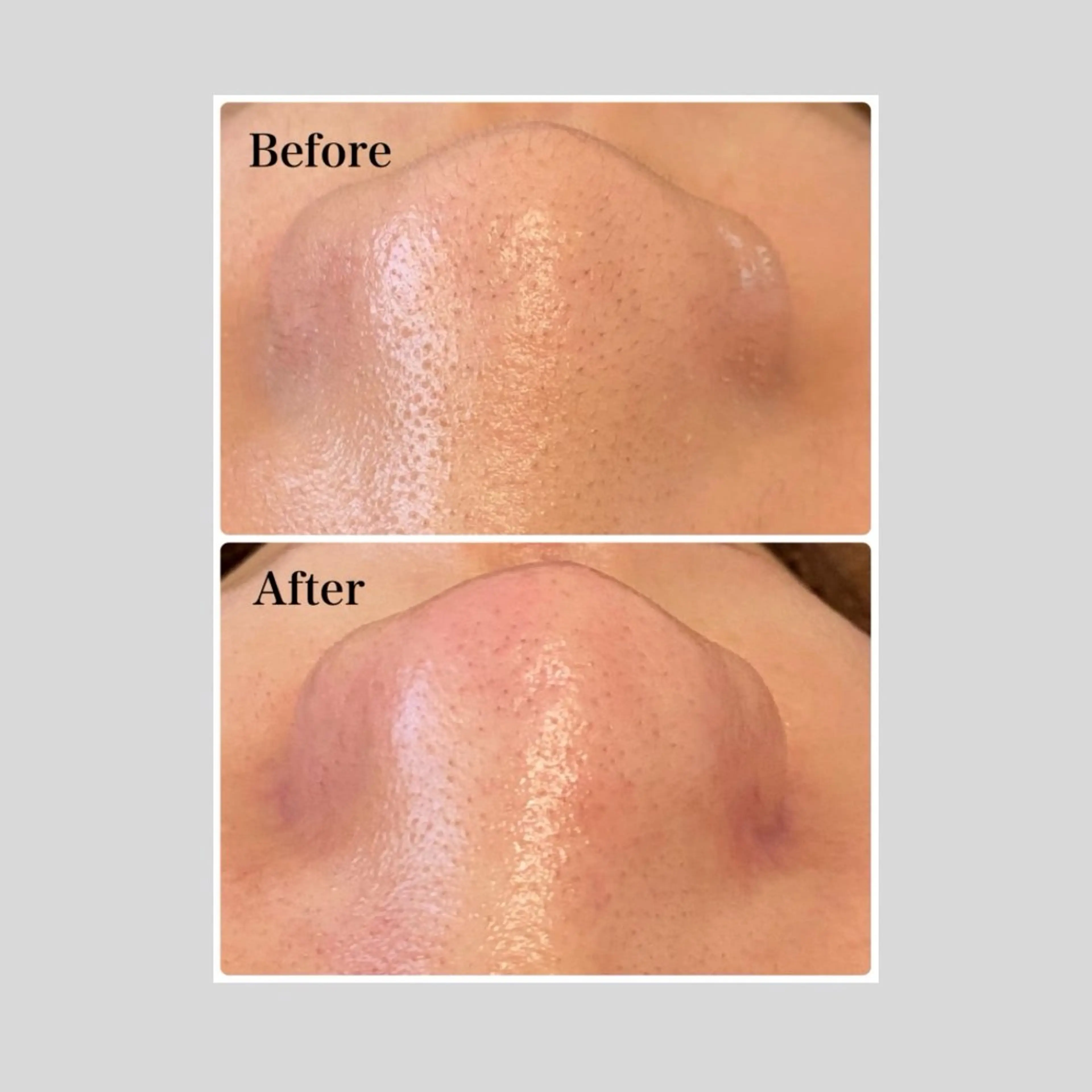 エステ リラク 韓国肌管理 【毛穴専科】のエステ・リラクイメージ