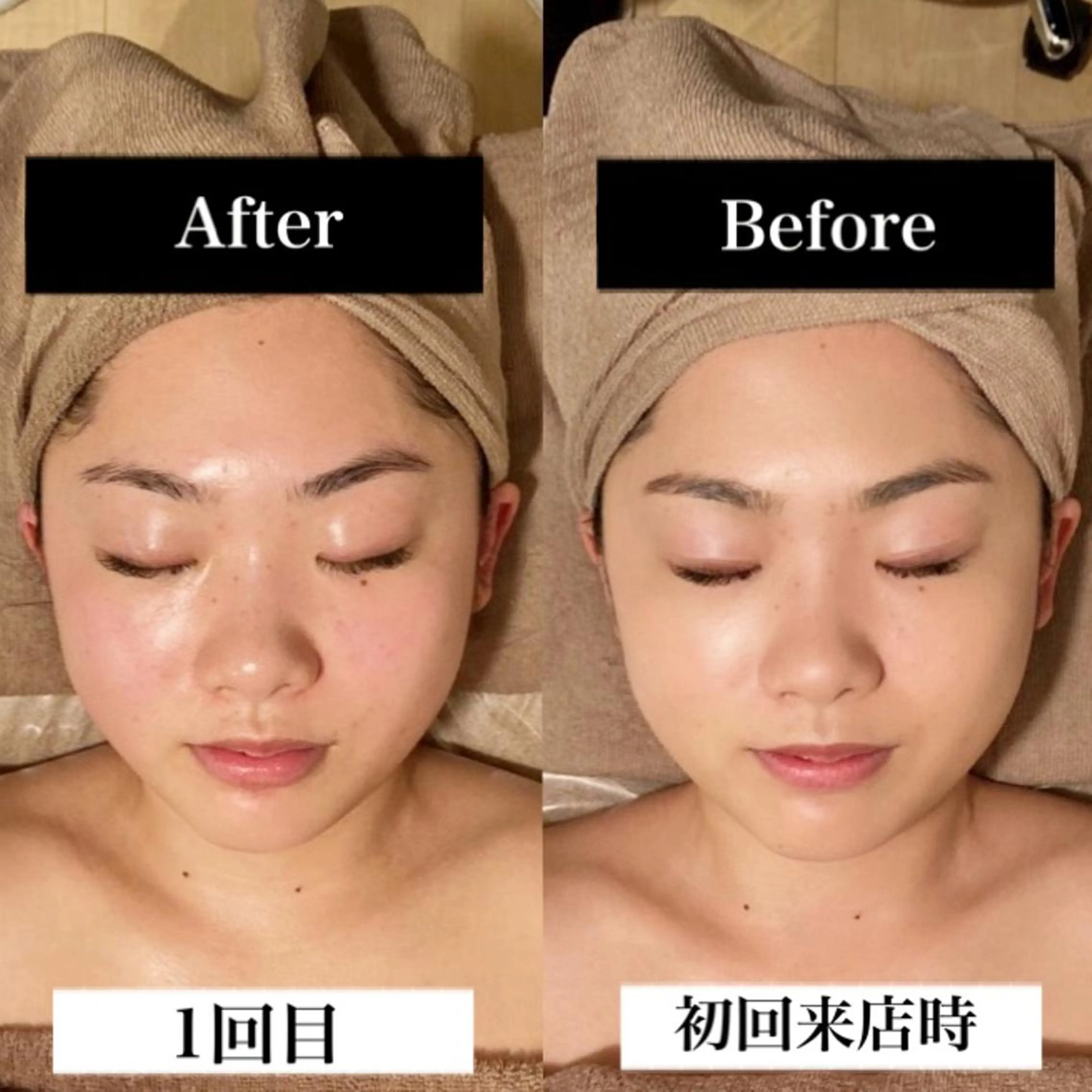 Ｂ&H所属・頭痛•肩こり専門/ 眉サロンB&H心斎橋のエステ・リラクイメージ