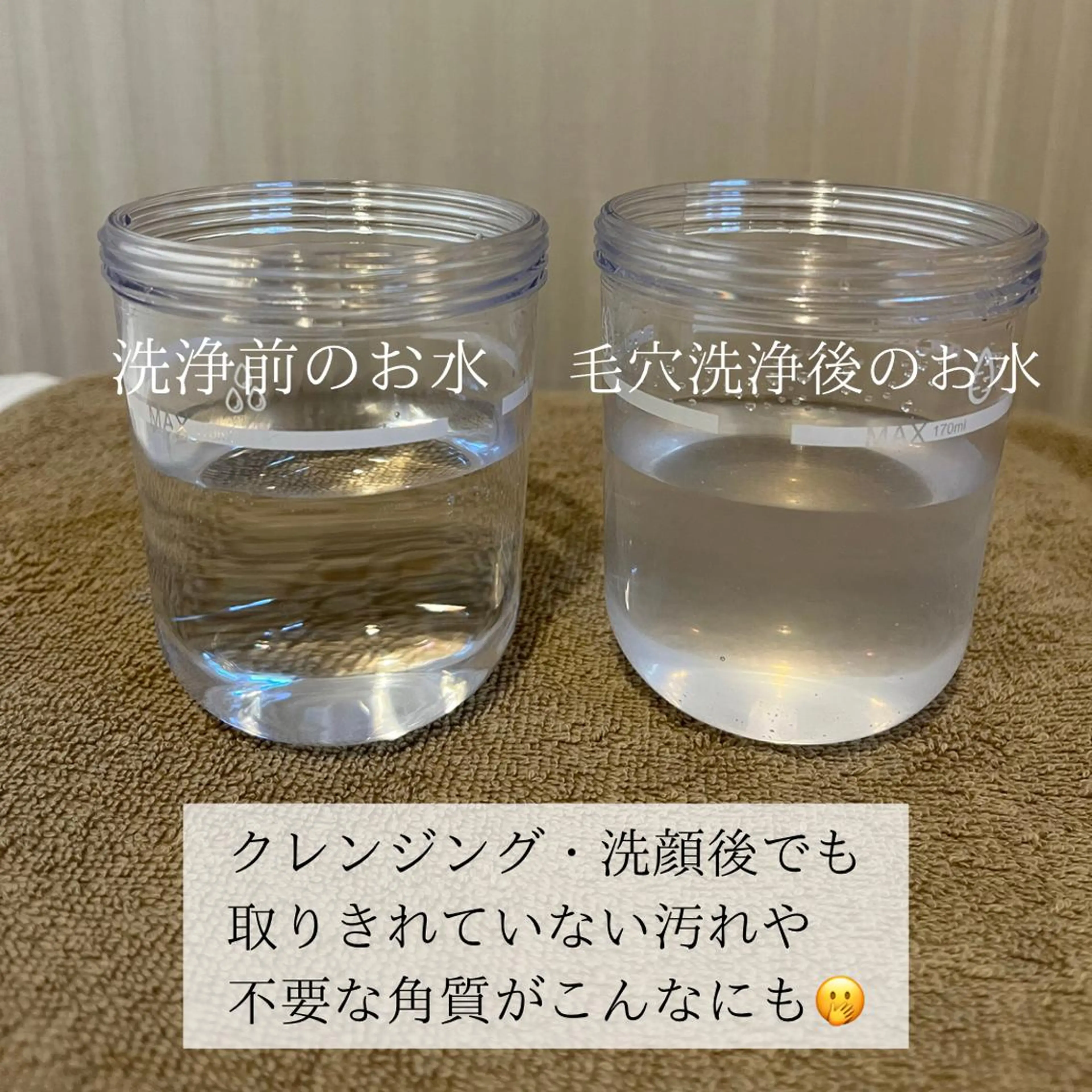 毛穴と美肌 littleroomのエステ・リラクイメージ