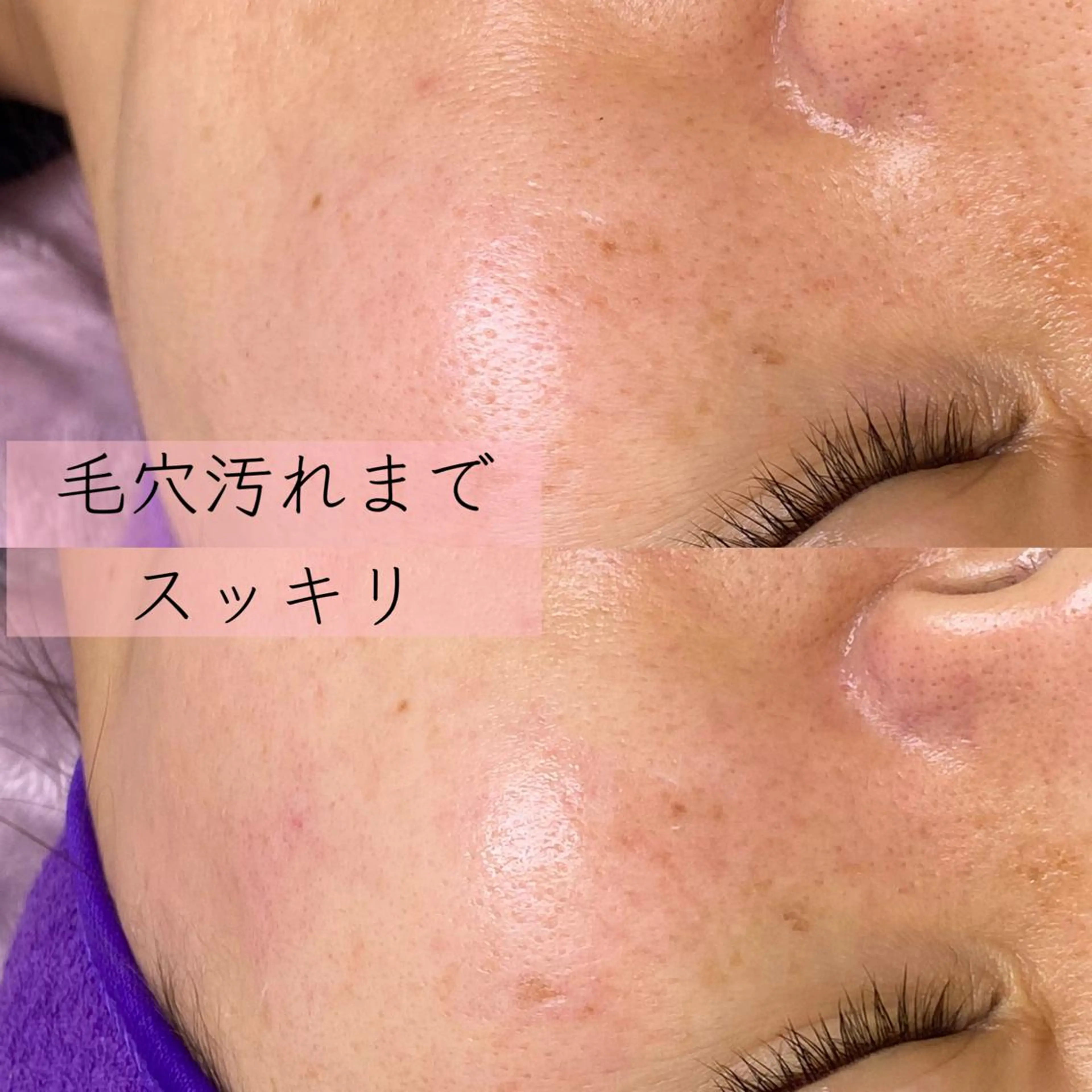 noheanc所属・まつげパーマ エクステのマツエク・マツパデザイン