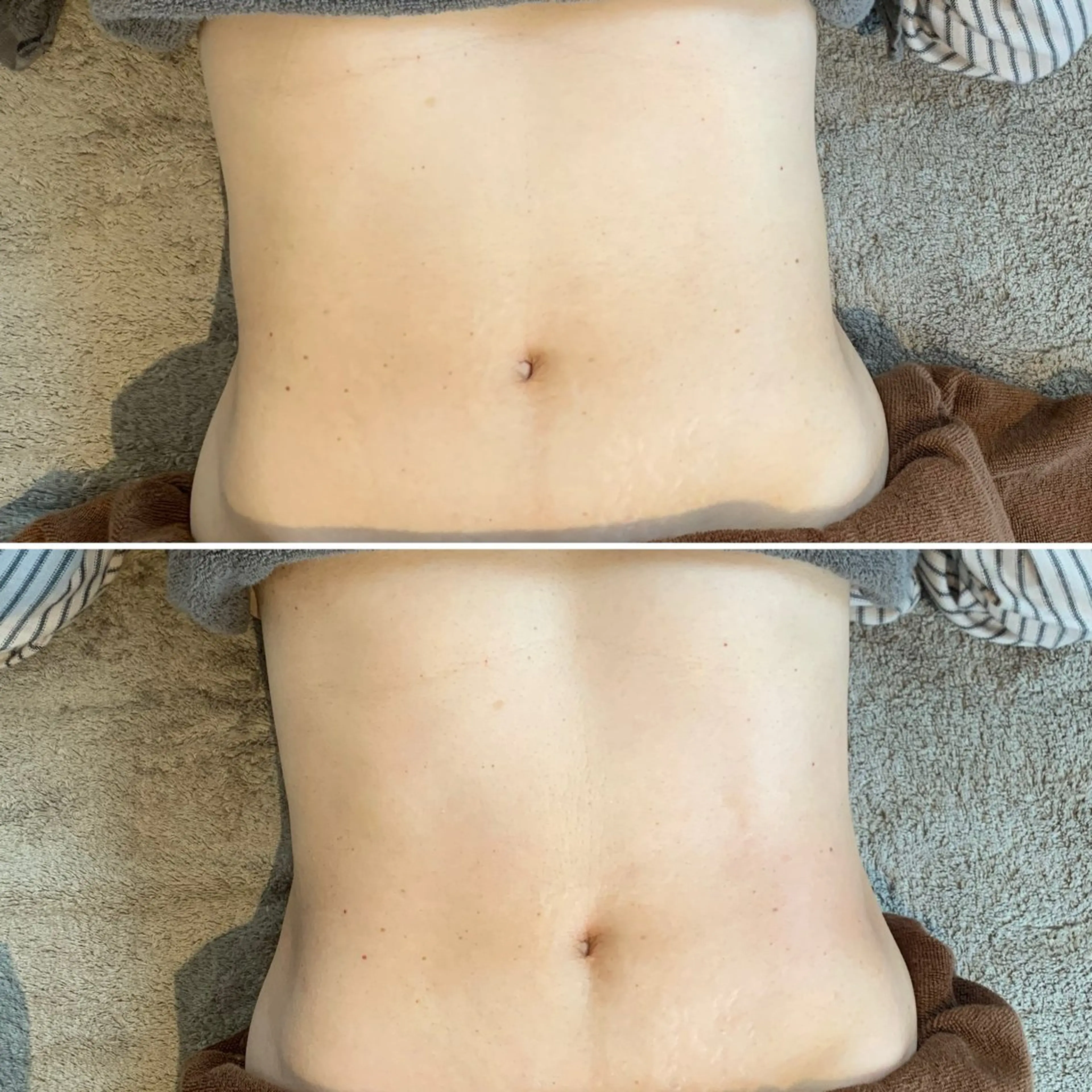 RiciL リシルのエステ・リラクイメージ