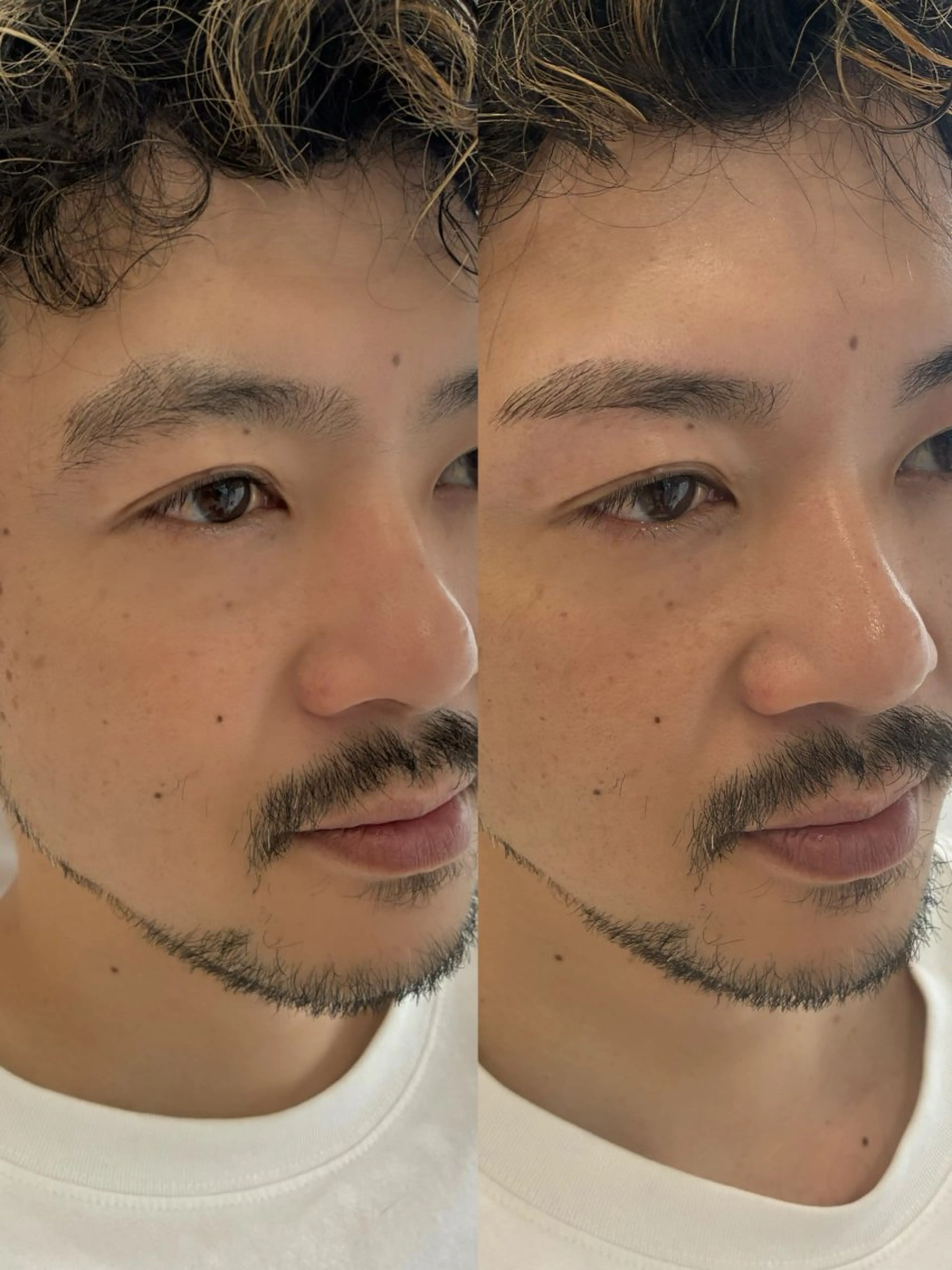 men's 美眉スタイリング🪄(wax脱毛)の写真