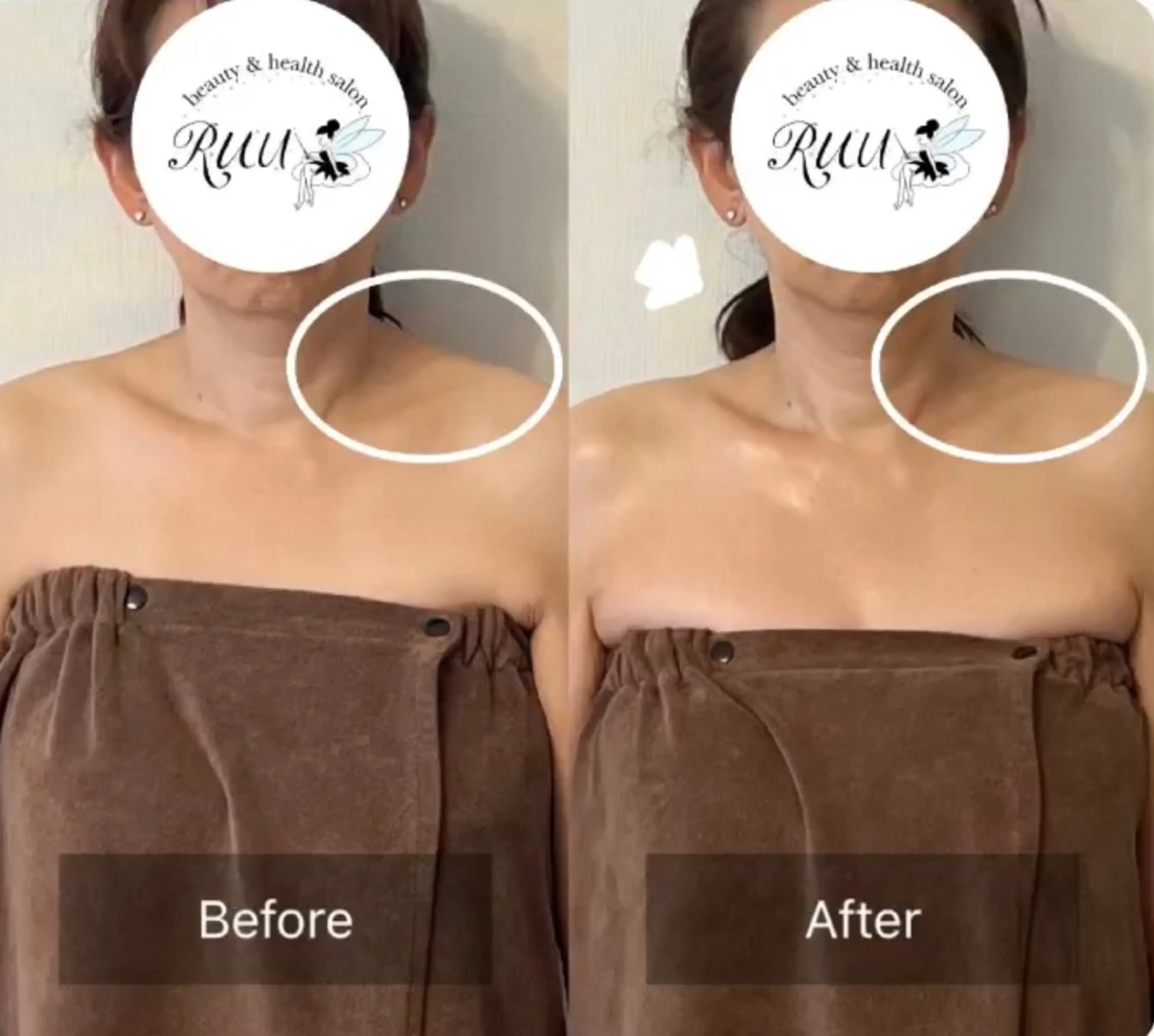 【頭痛、睡眠改善】 salon RUUのエステ・リラクイメージ