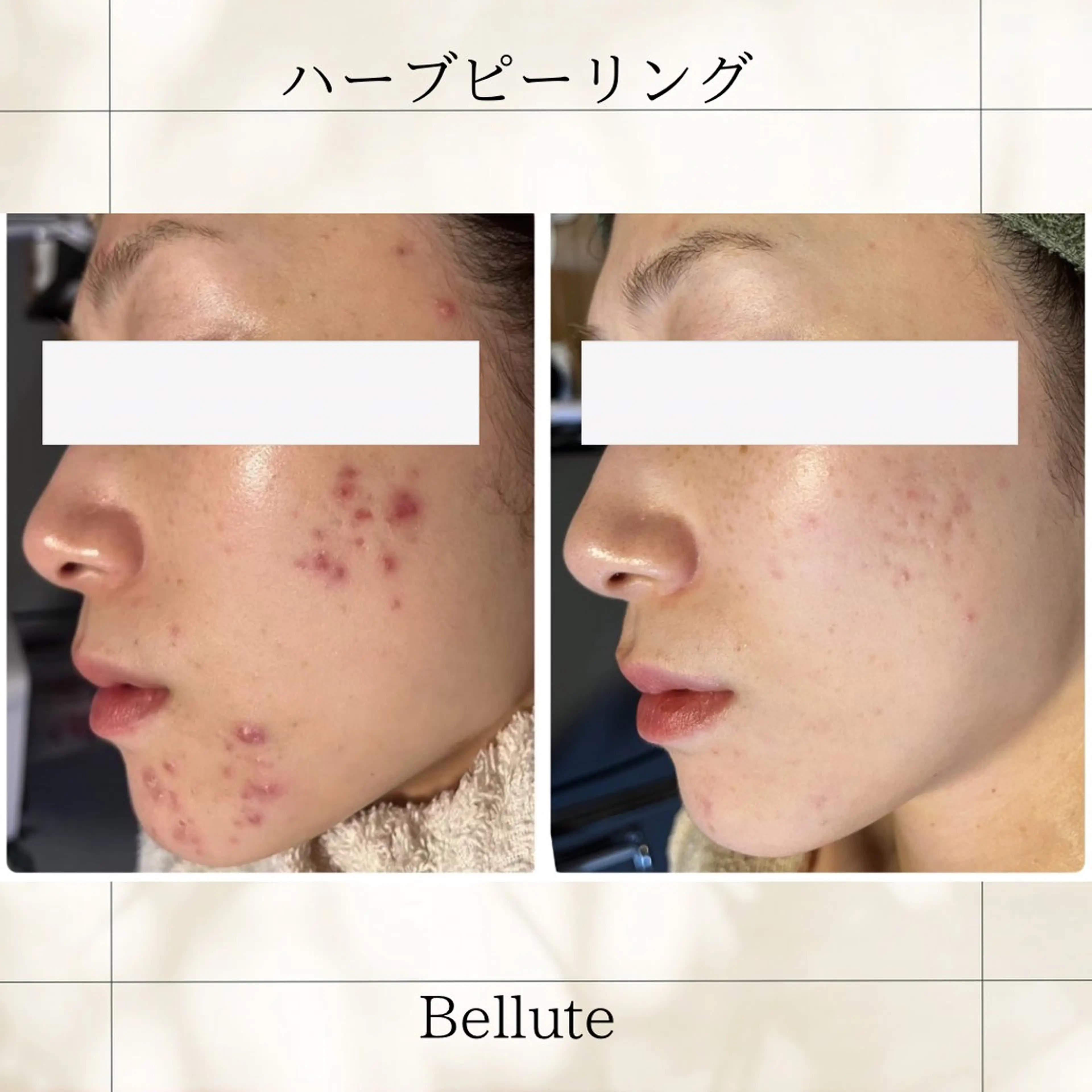 エステ リラク ピーリング専門店 Belluteのエステ・リラクイメージ