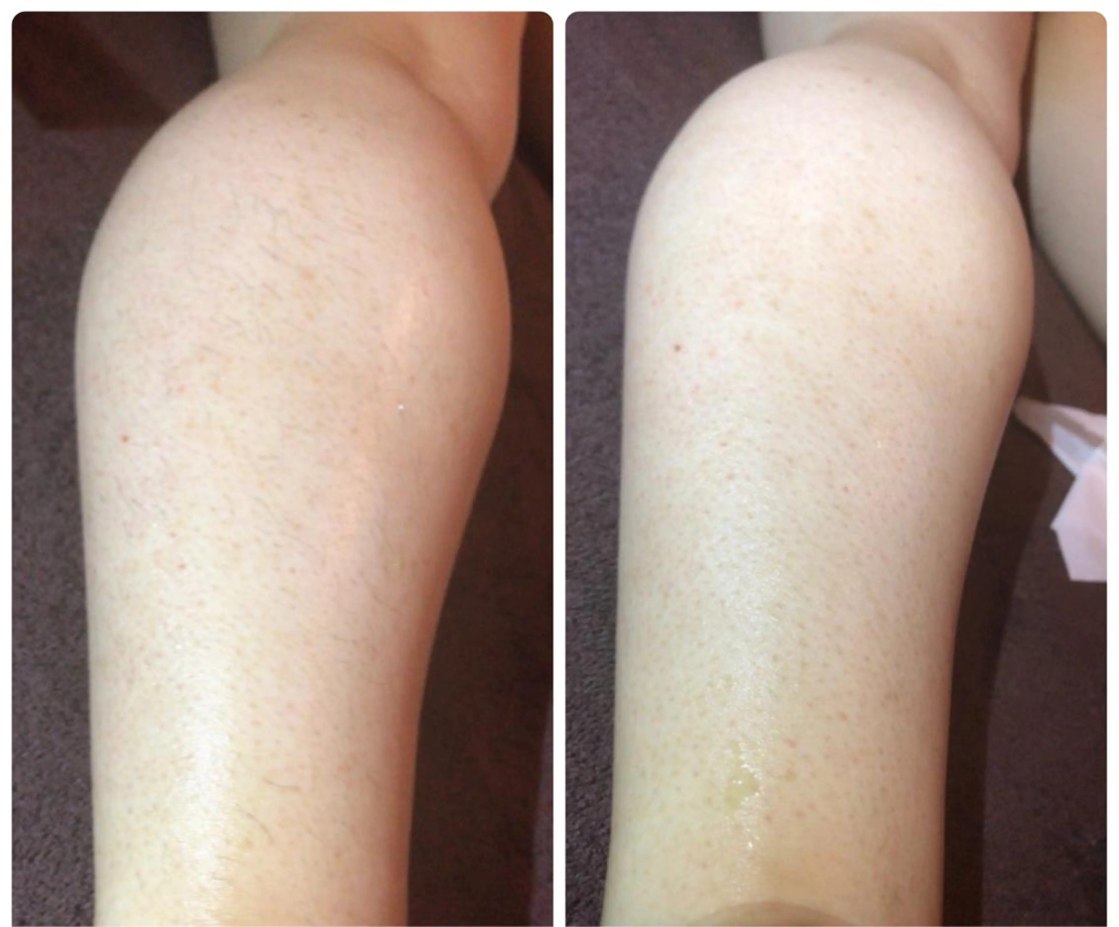 代表 MOMOのエステ・リラクイメージ