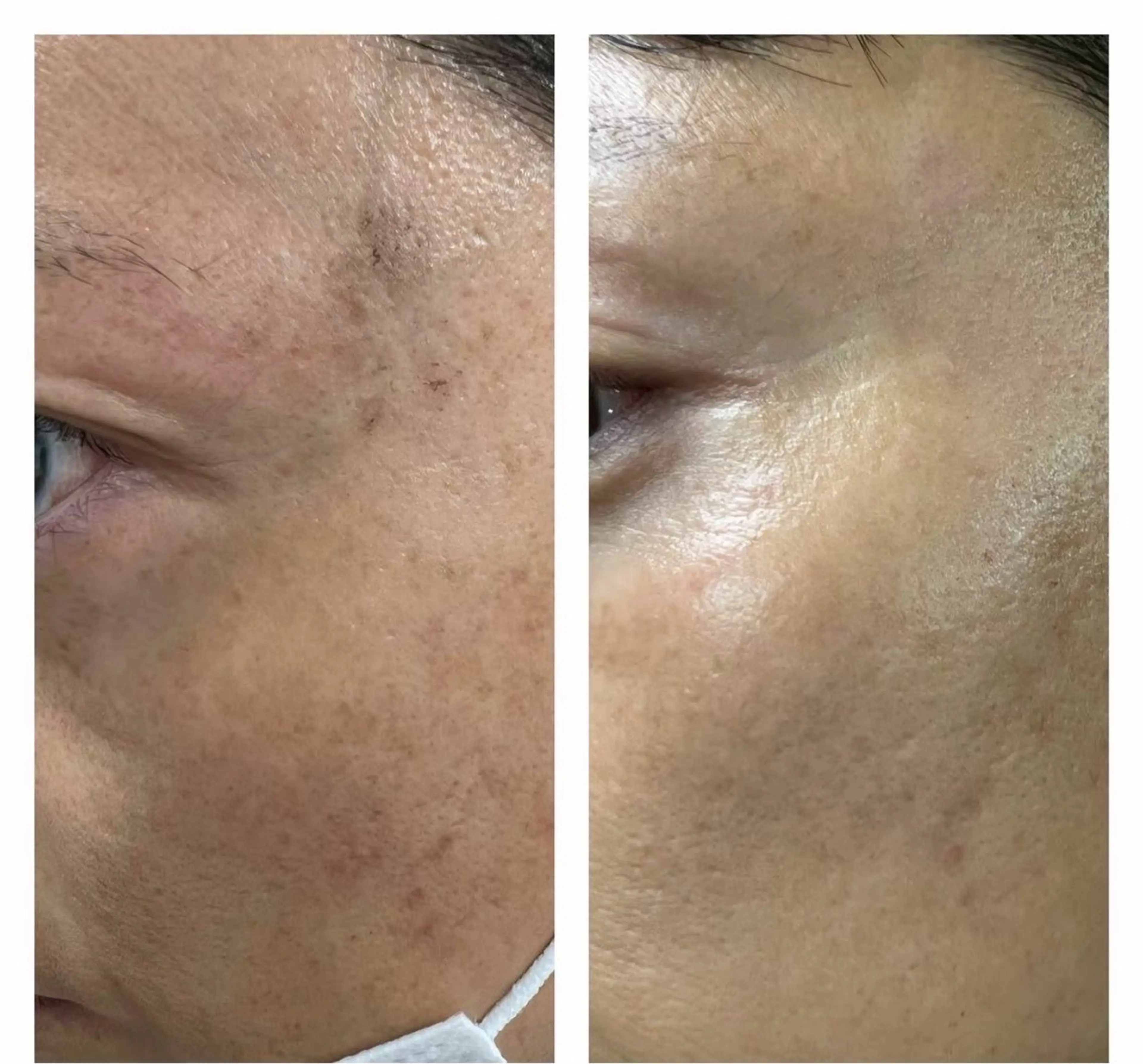 エルモサ痩身脱毛　西八王子店所属・エルモサ痩身脱毛 西八王子店のエステ・リラクイメージ