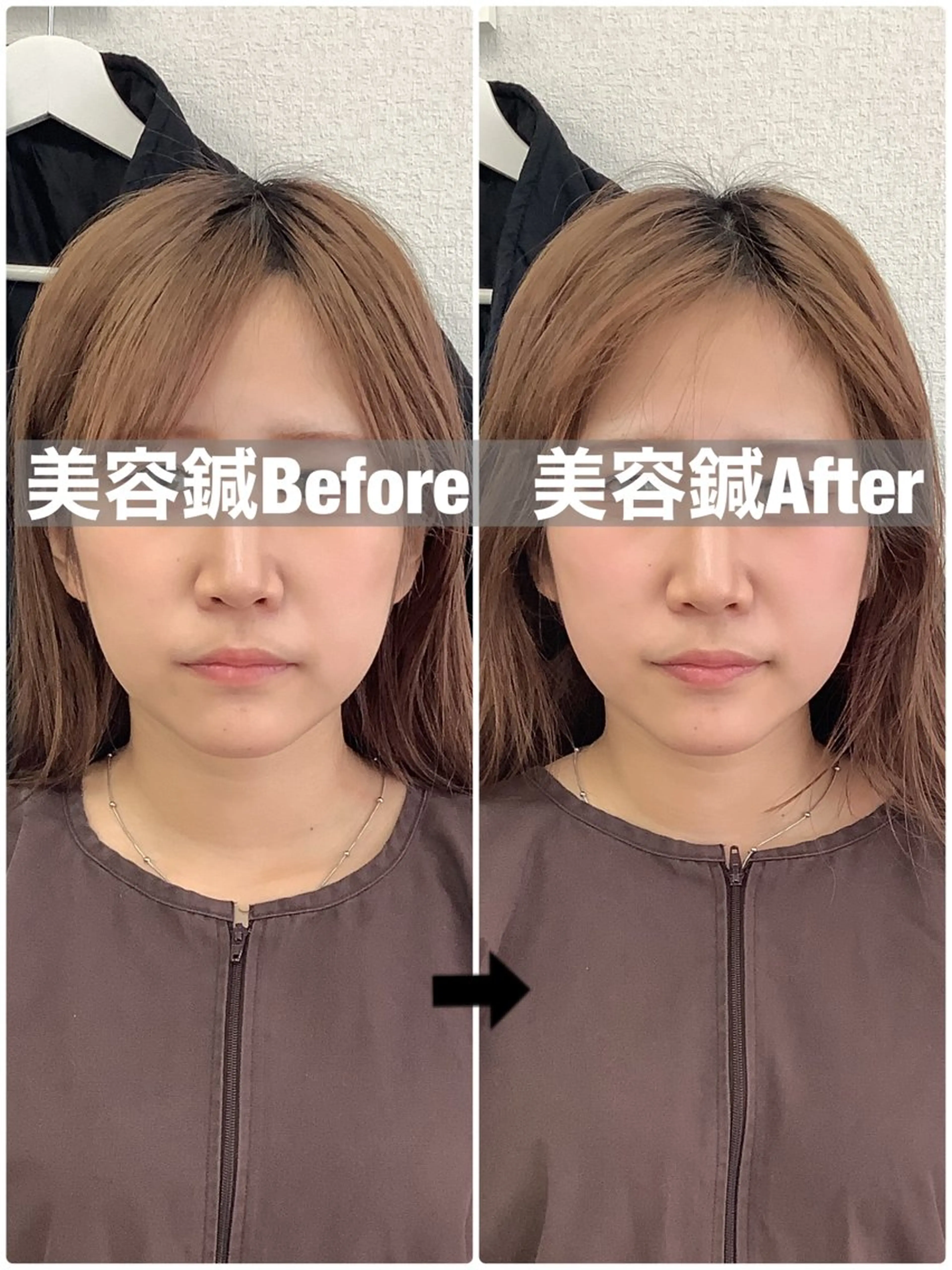 エステ リラク メディカルサロンドオフ所属・ハリサロンドオフ 美容鍼灸×小顔整体のエステ・リラクイメージ