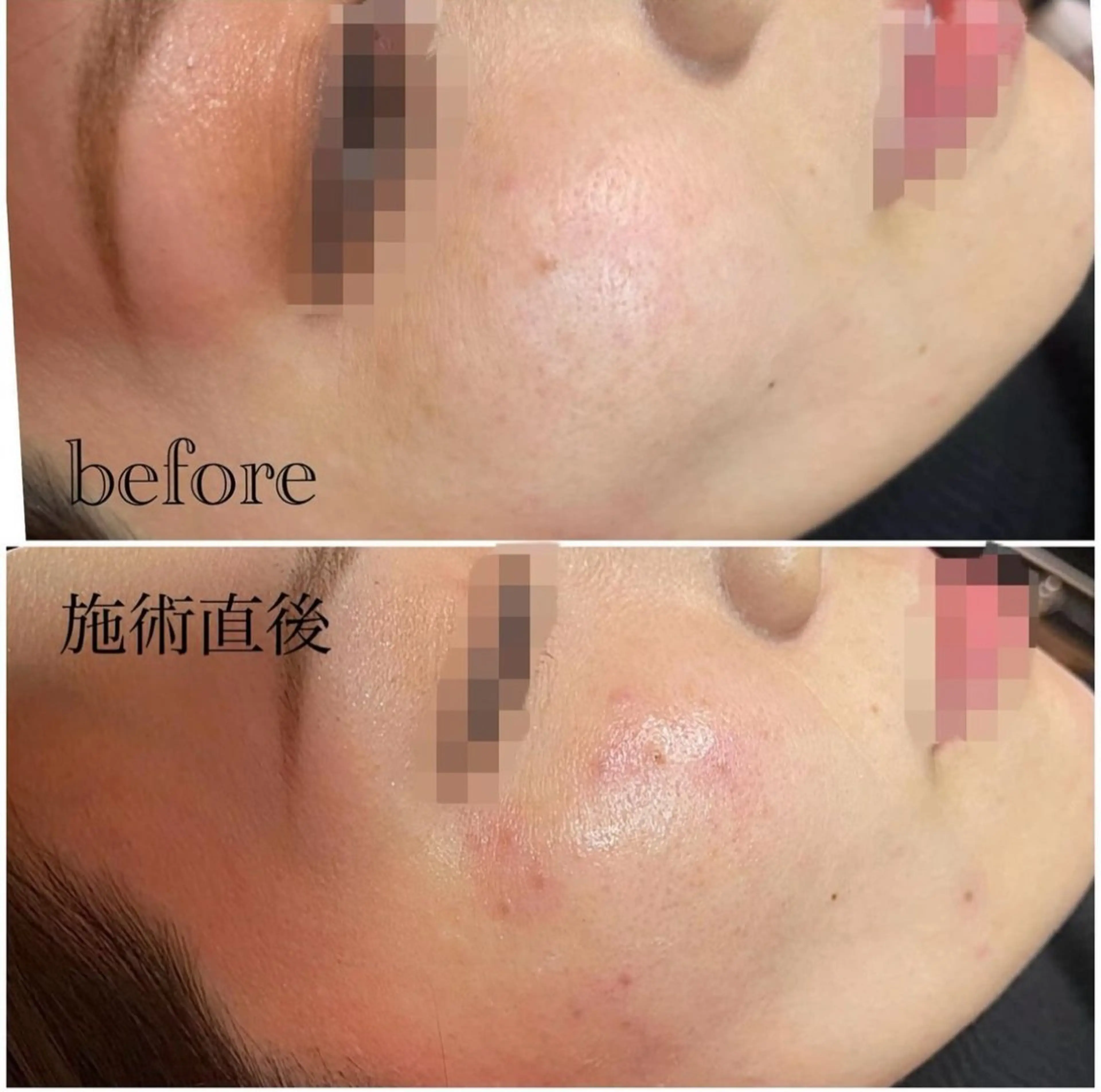 シミケア専門店 Saimervellのエステ・リラクイメージ