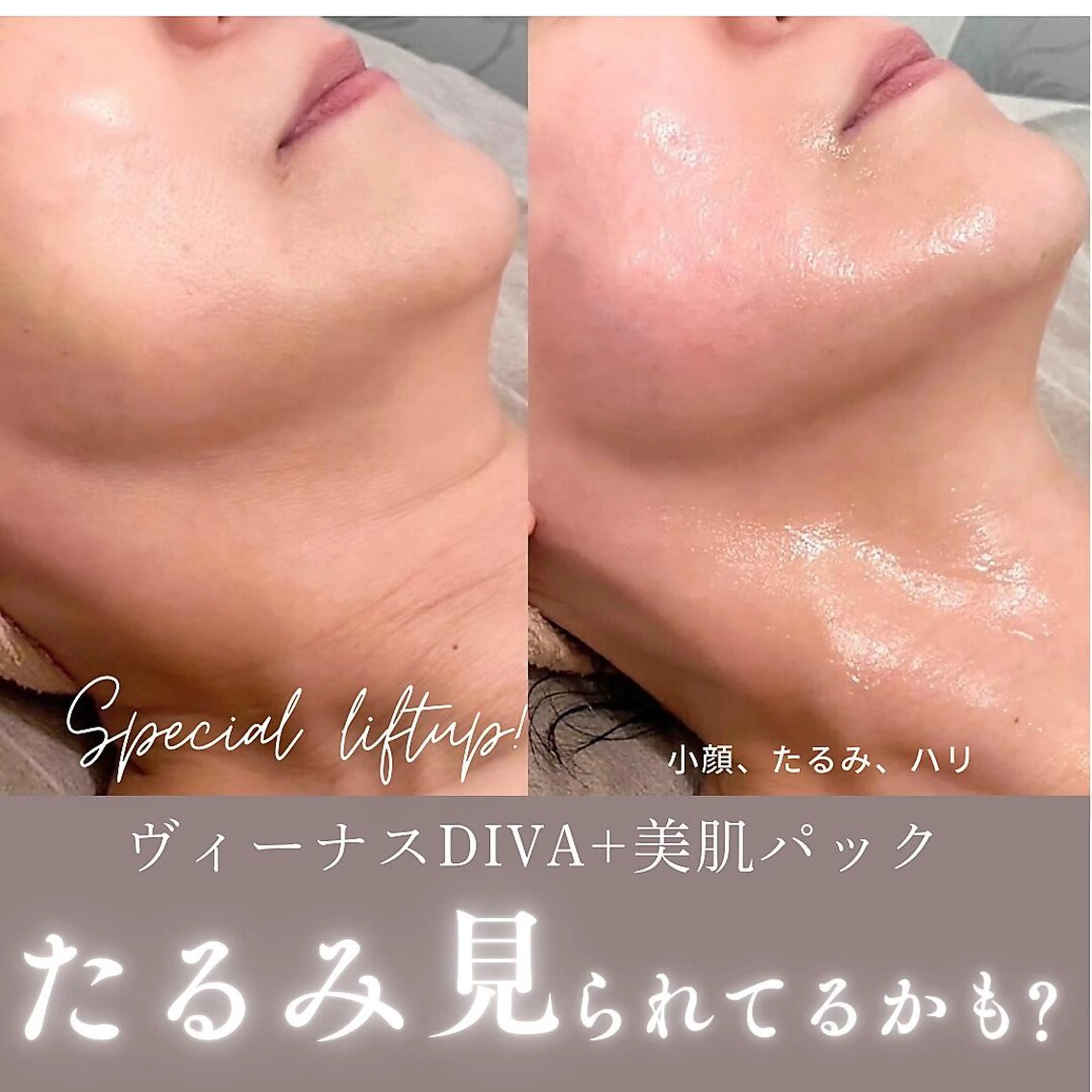 🎀最強リフト!国際特許🎀◆小顔◆ヴィーナスDIVA+美肌パックの写真
