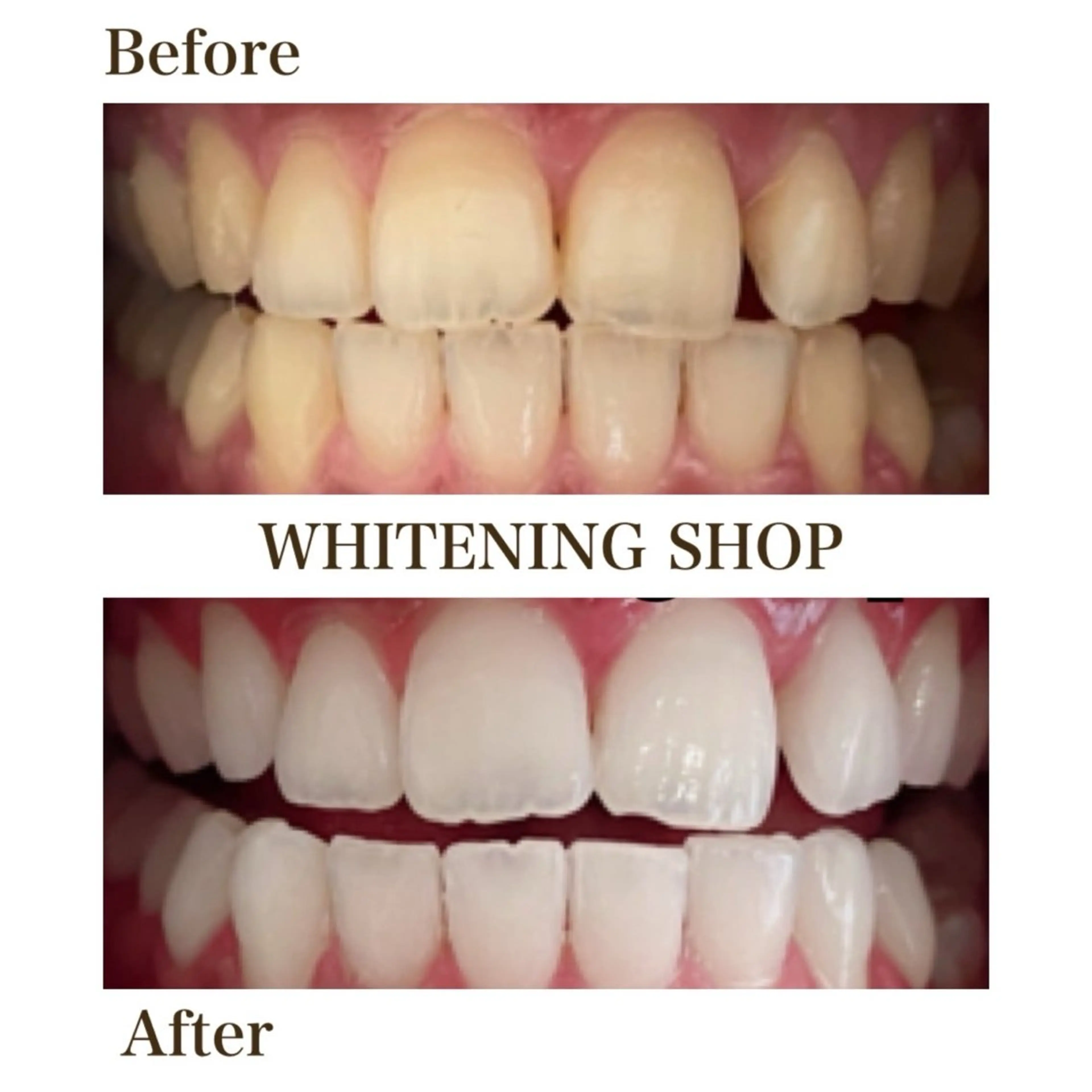 ホワイトニングショップ倉敷店所属・ホワイトニング ショップ倉敷店のエステ・リラクイメージ