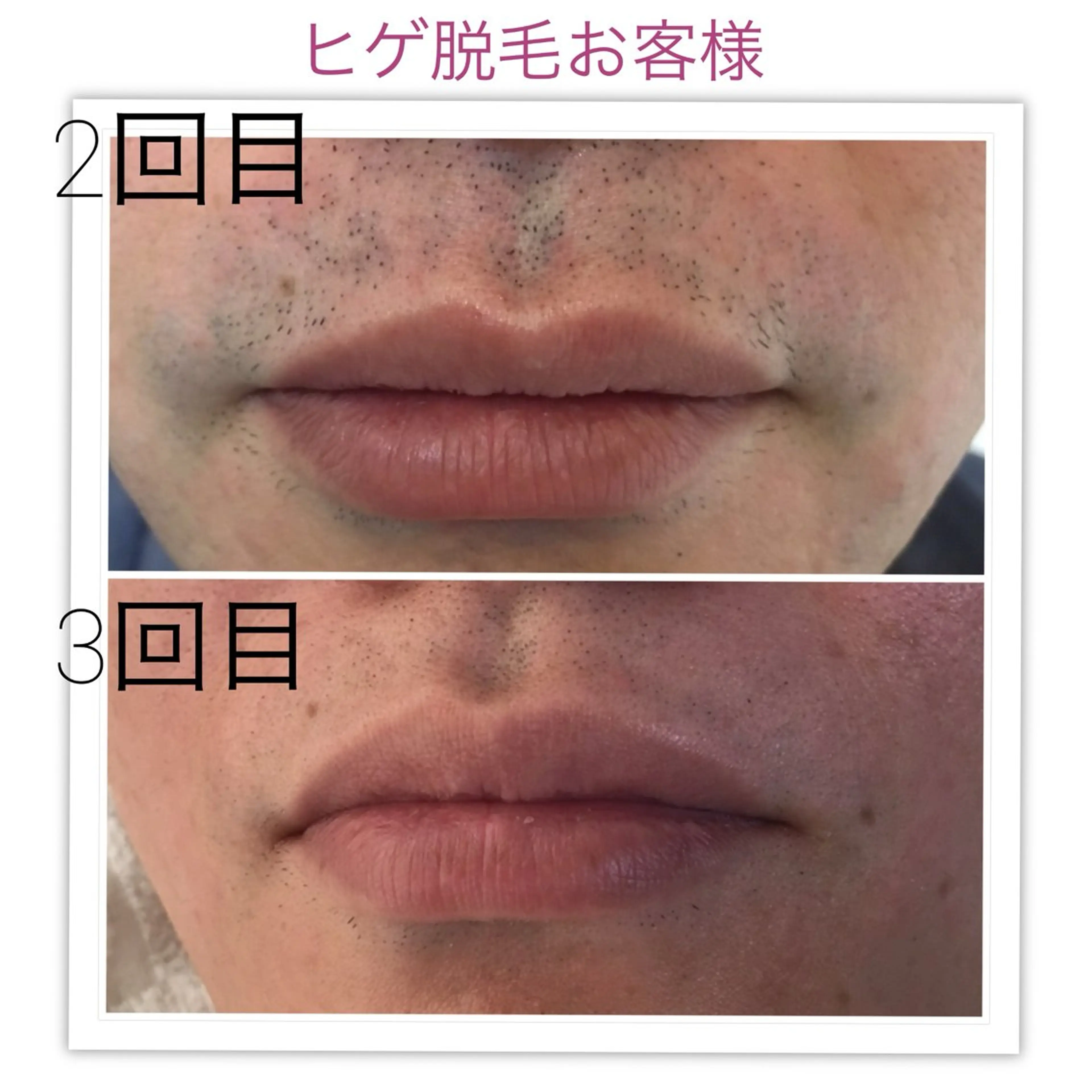 メンズ 脱毛サロン CHAPPYのエステ・リラクイメージ