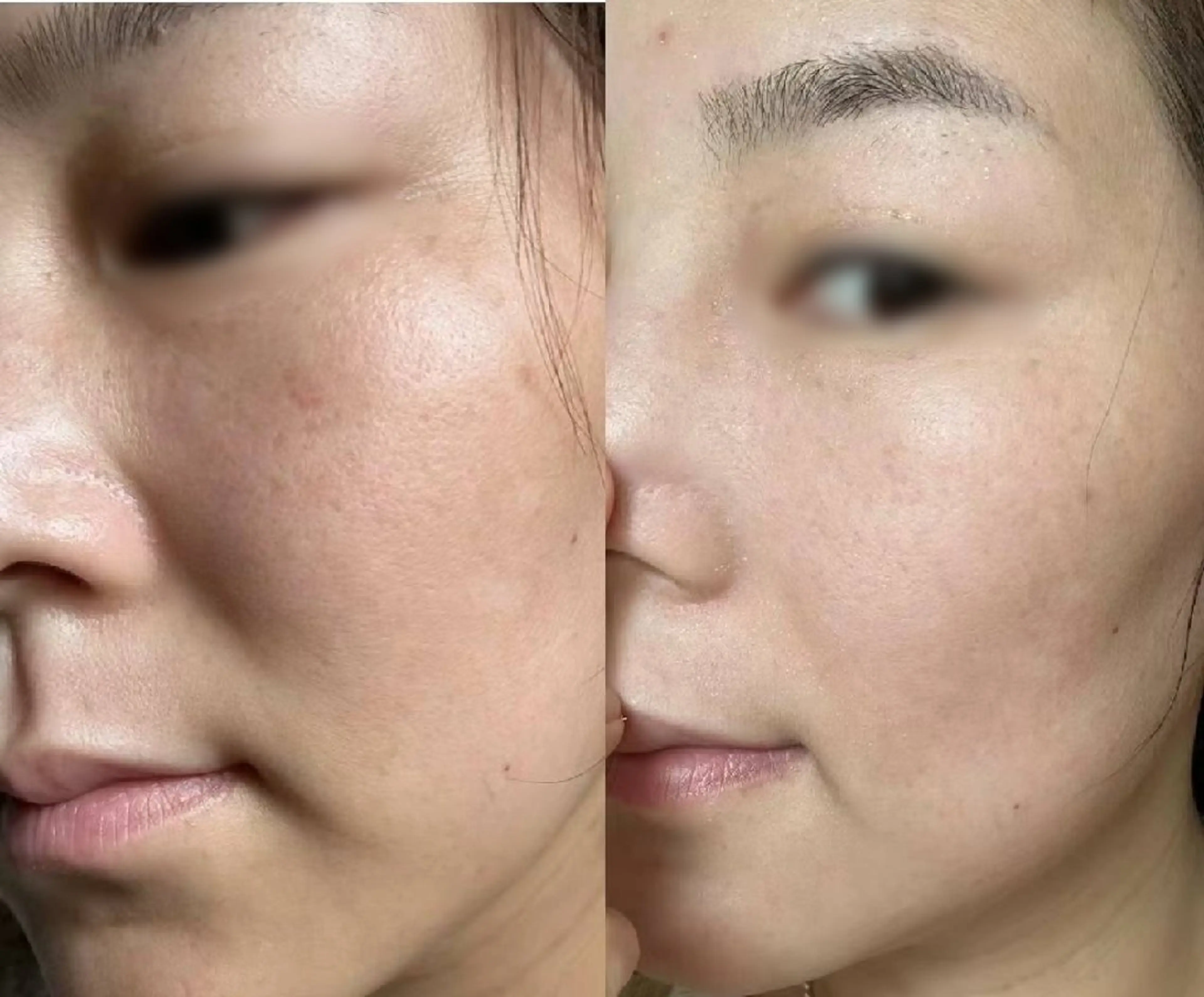 マツエク・マツパ 韓国風マツエク 結婚式・ブライダル aliaハイフ&水光ジェットサロン所属・aliaハーブ水光店 エステティシャン募集のエステ・リラクイメージ