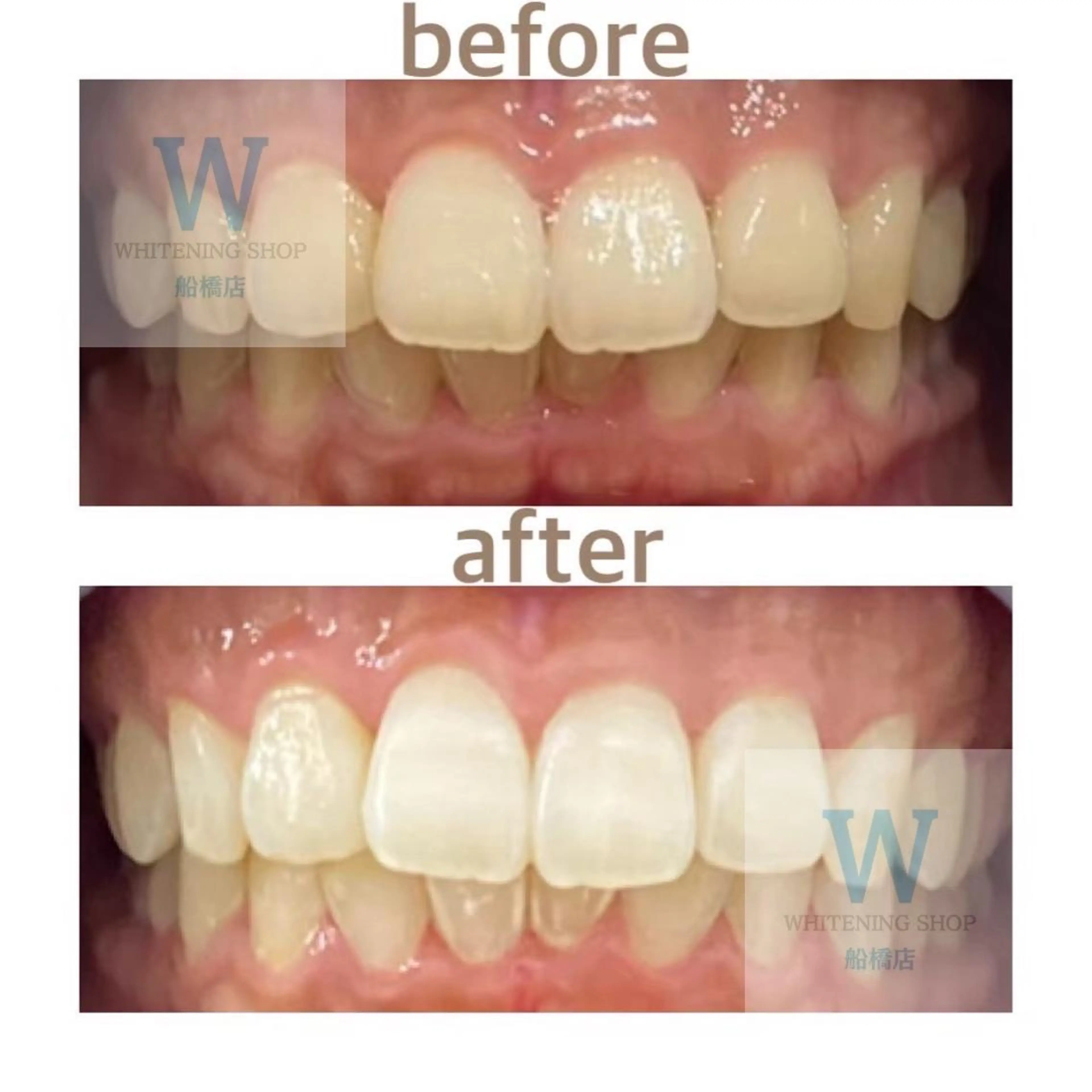 エステ リラク ホワイトニング ショップ船橋店🦷のエステ・リラクイメージ