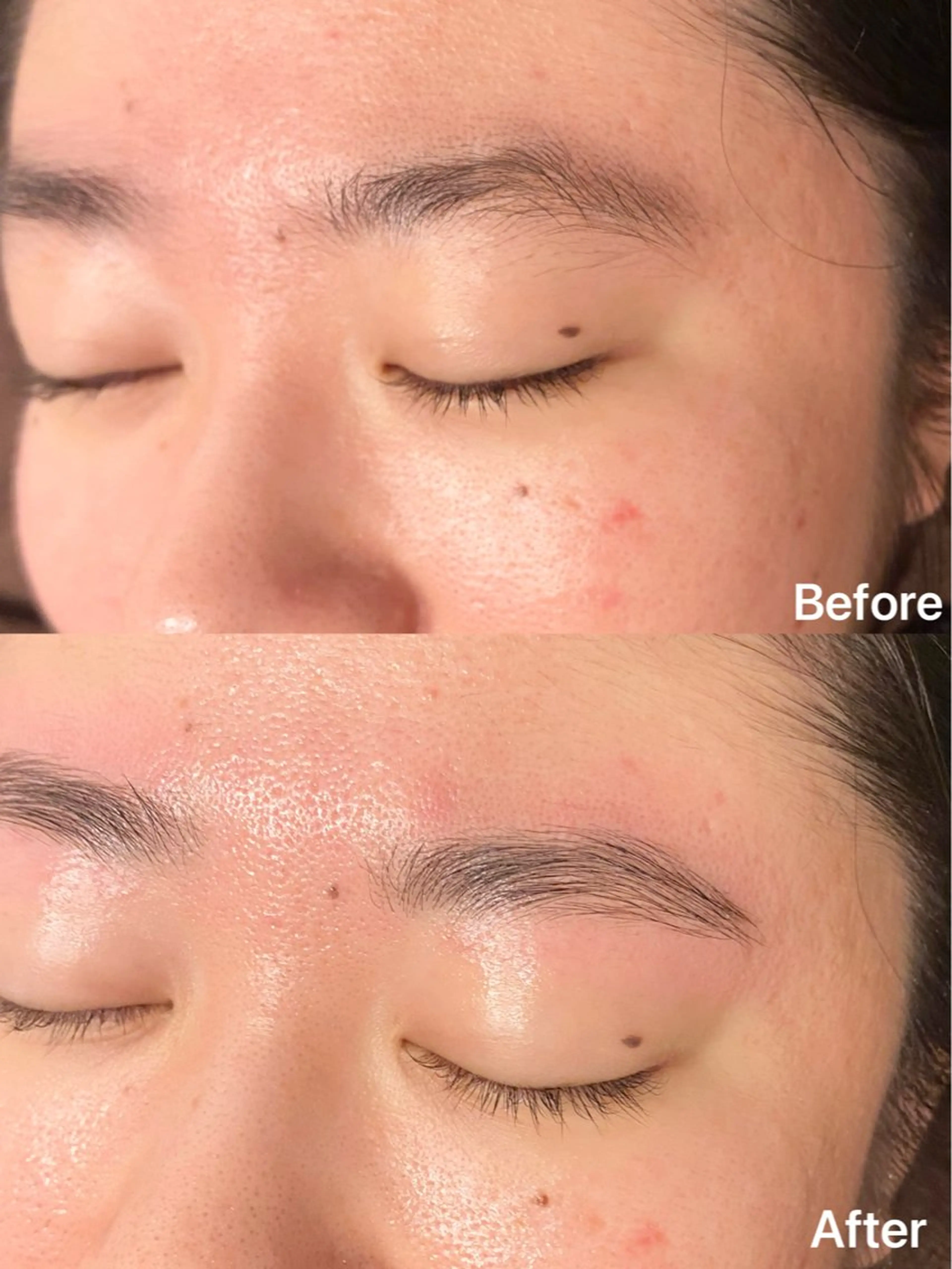 HBL眉癖改善施術+フェイシャルワックス脱毛(おでこor両頬)カウンセリング→眉癖改善→ワックス脱毛→毛抜きの写真