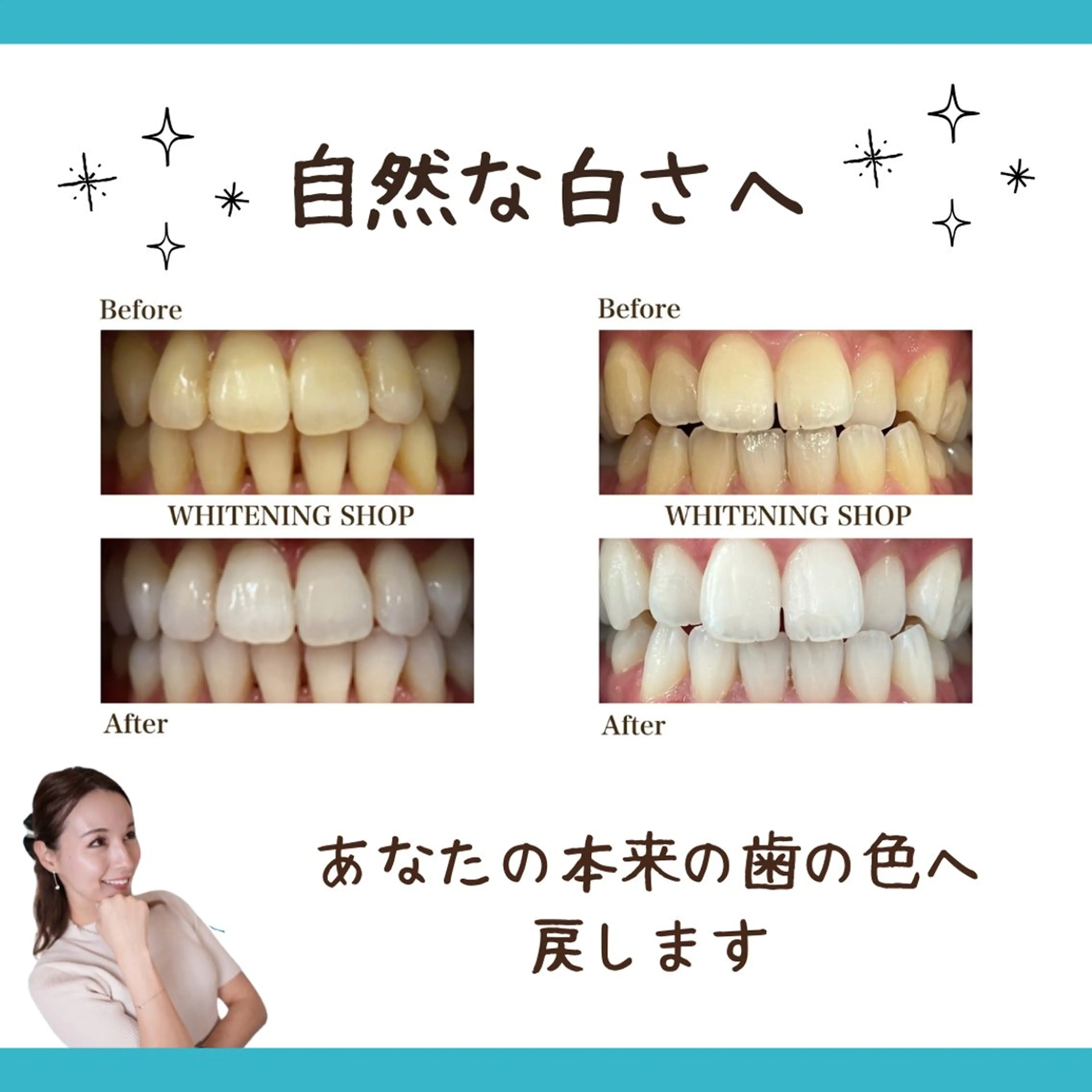 メンズ ホワイトニング ショップ多摩店のその他イメージ