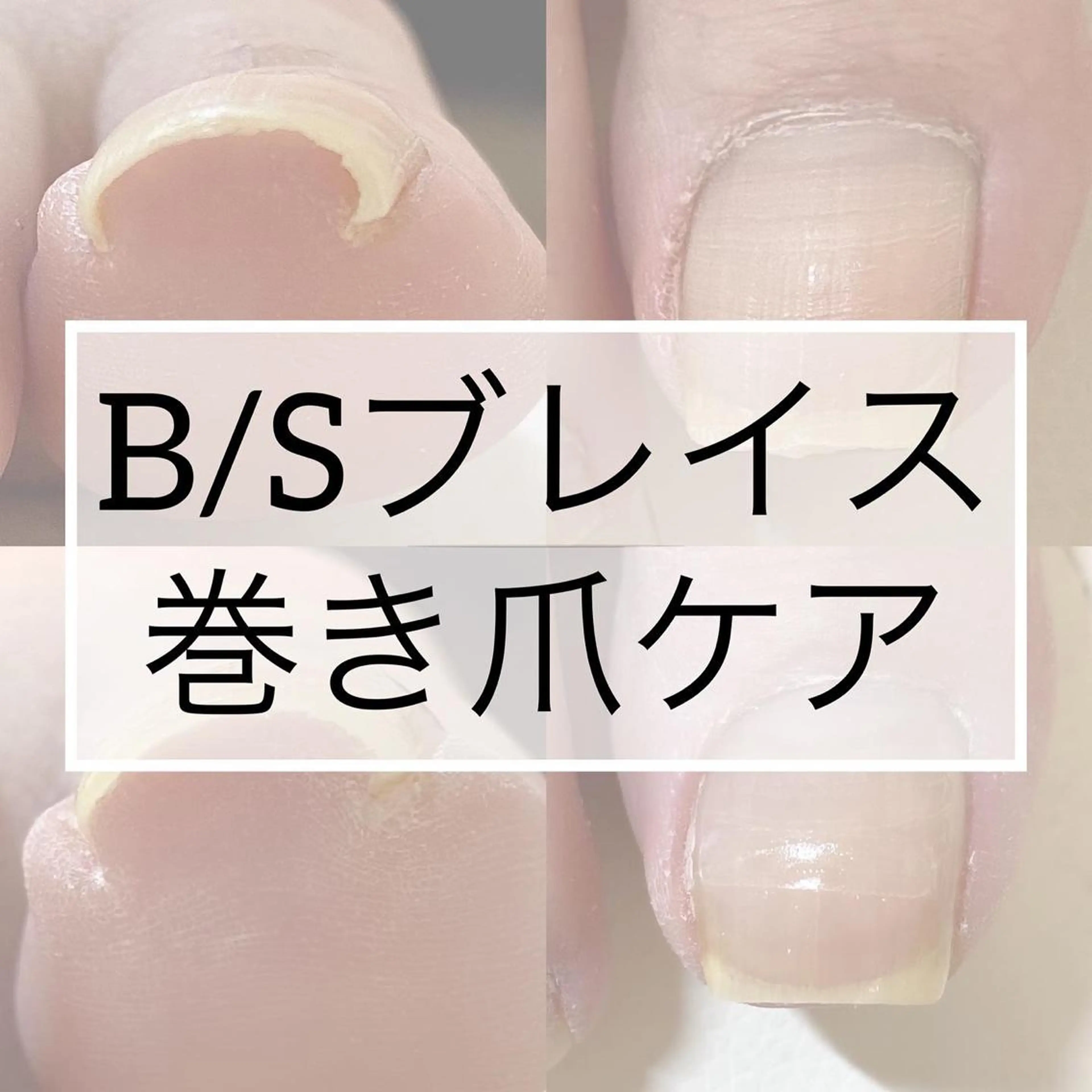 ネイル フットネイル JILL sa-yaのネイルデザイン