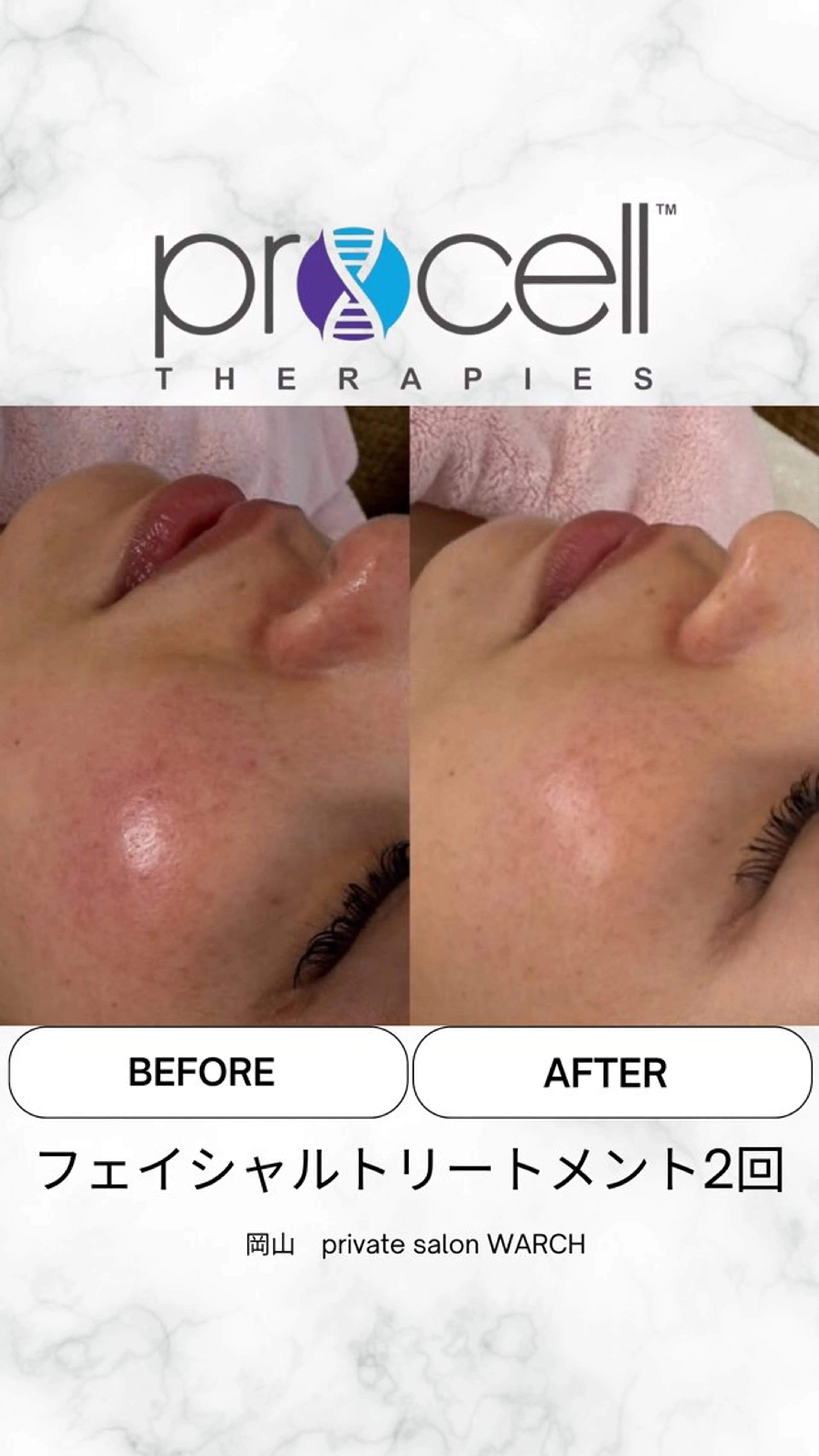 WARCH Marieのその他イメージ