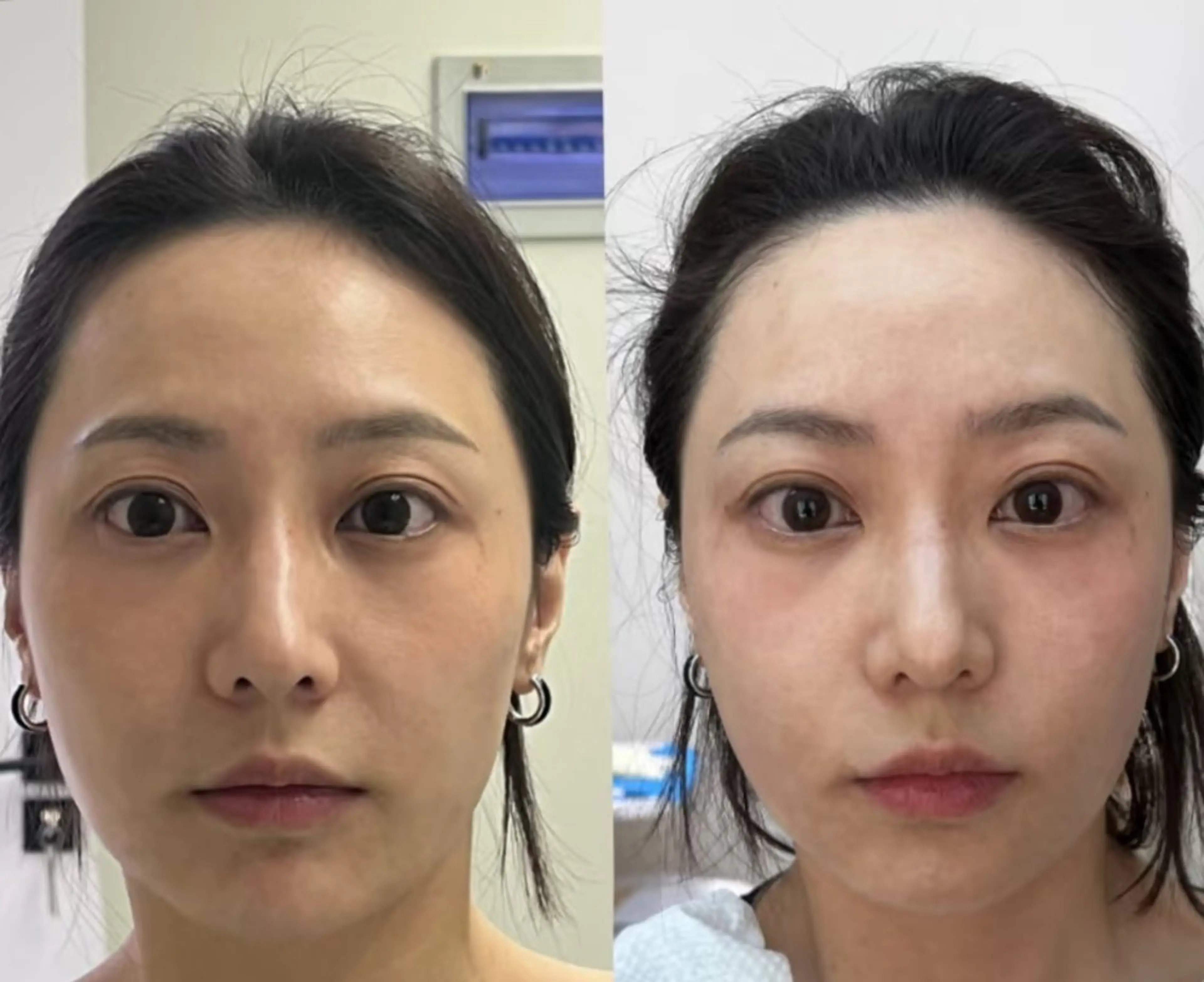 その他 aliaハイフ&水光ジェットサロン所属・aliaハーブ水光店 エステティシャン募集のエステ・リラクイメージ