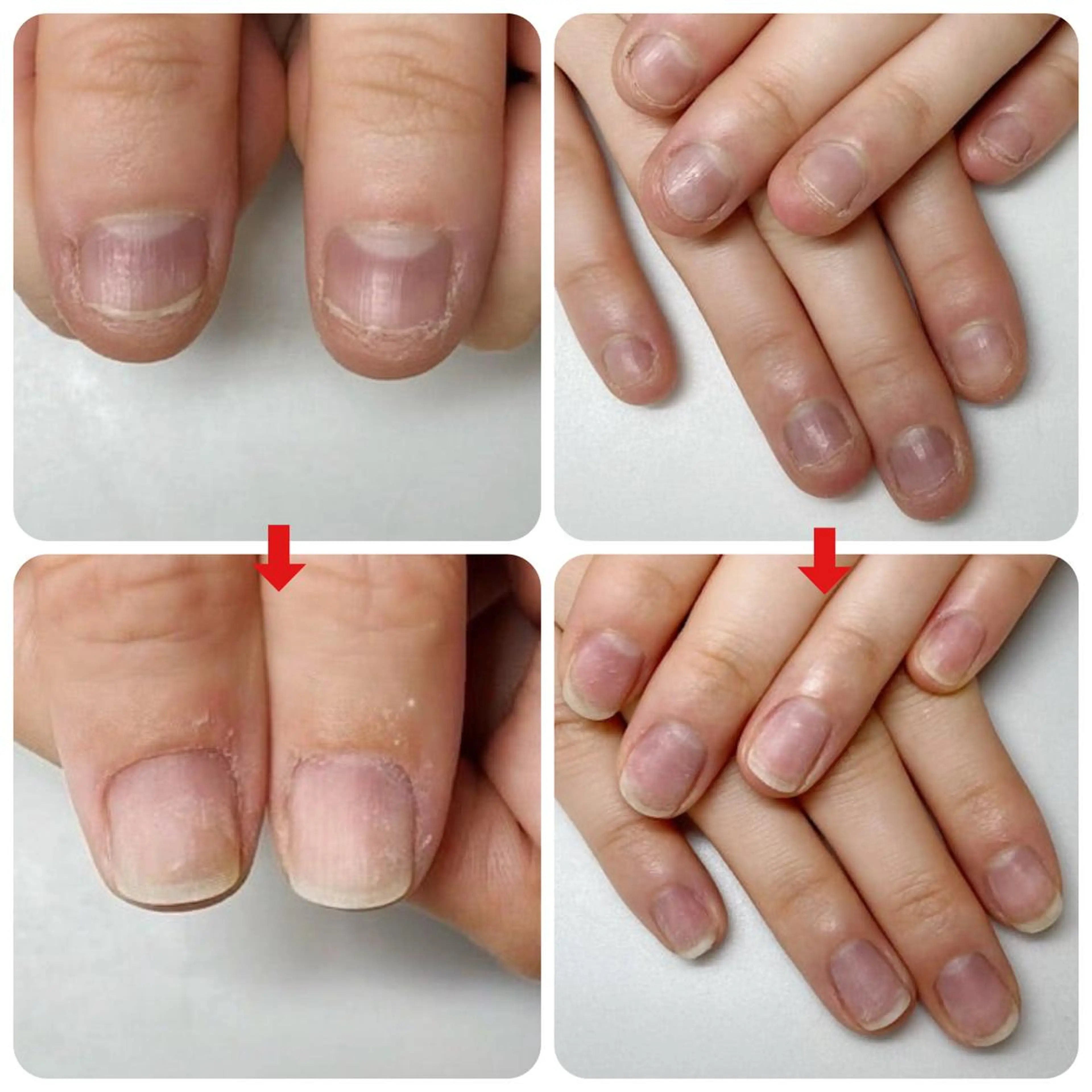 ネイル ネイルサロンアリューム所属・ネイルサロン アリュームのネイルデザイン