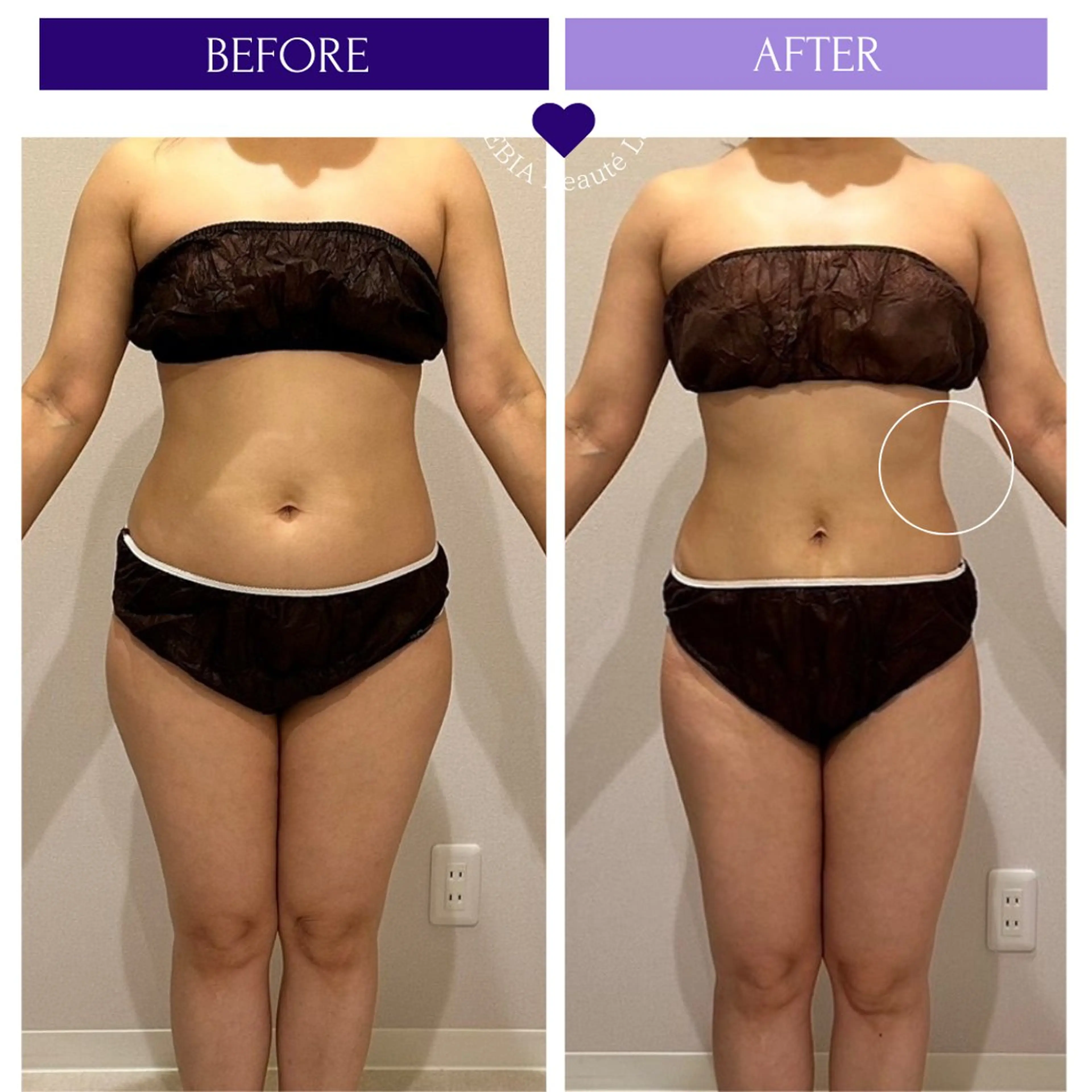 エステ リラク 小顔＆まつ毛サロン AKANE❤️のエステ・リラクイメージ