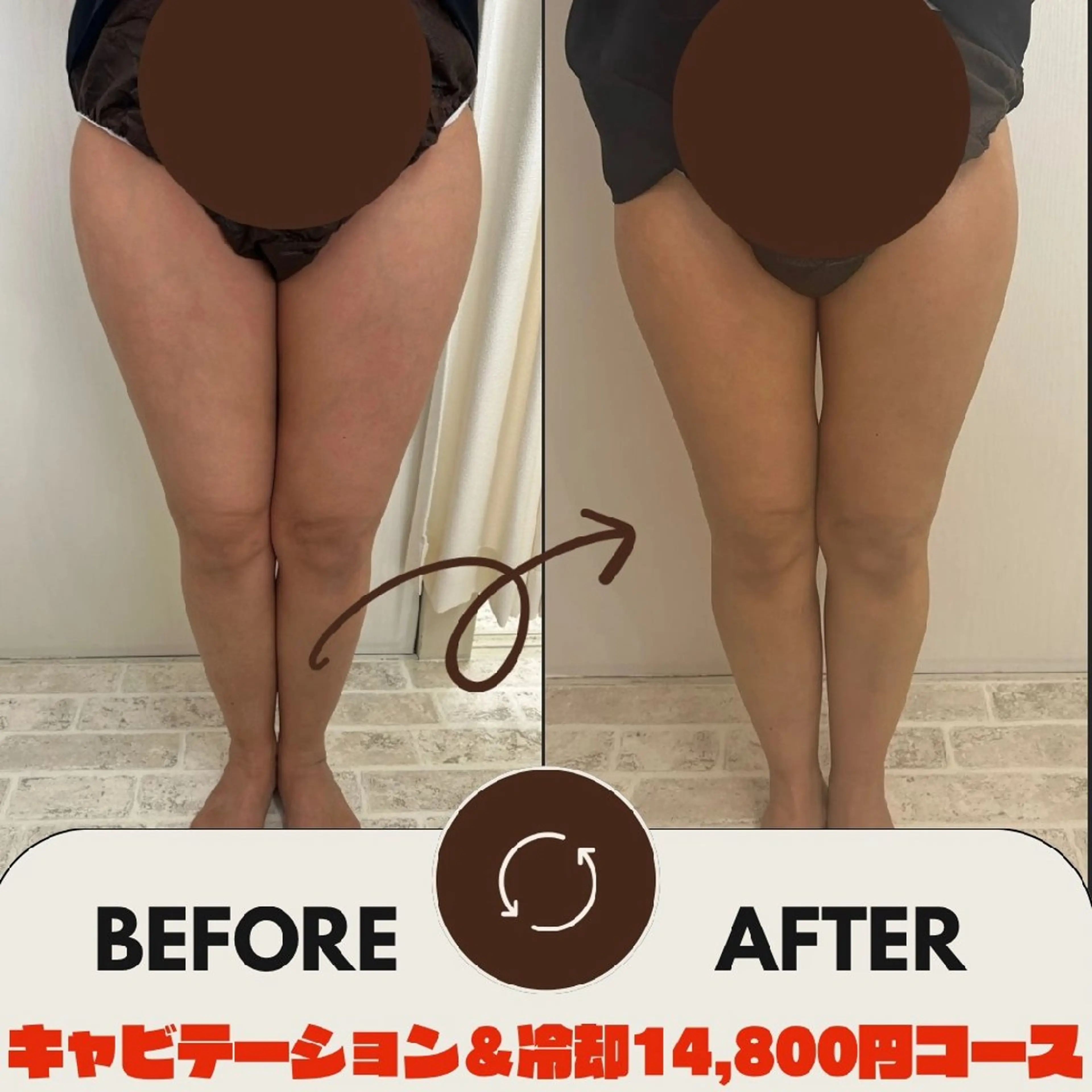 脂肪冷却・脱毛・フェイシャルサロンcoconoix [ｺｺﾉﾜ]所属・脂肪冷却・脱毛サロン coconoix のエステ・リラクイメージ