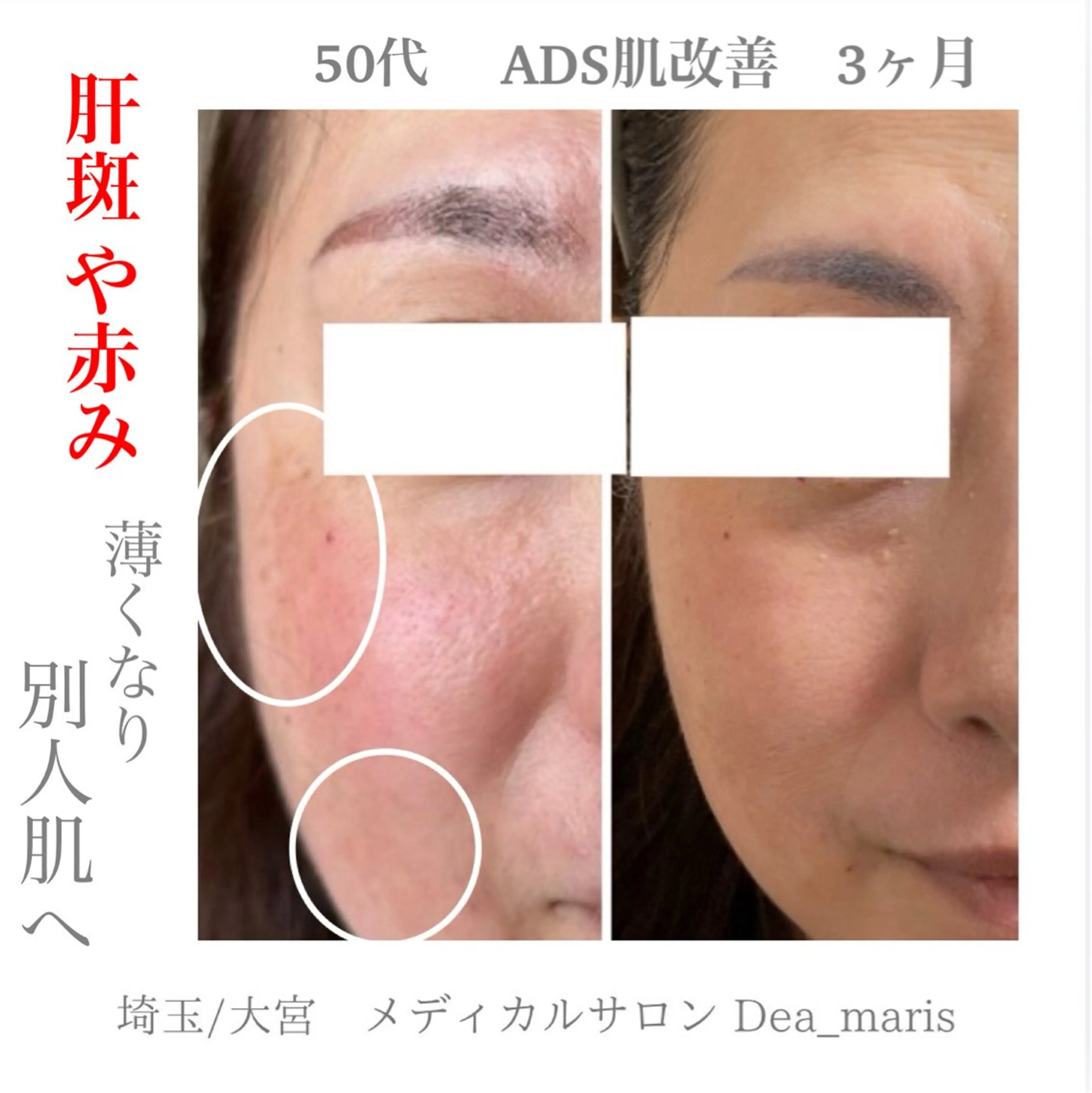 private salon  Dea_maris シュガーリング＆パーソナルボディケア所属・シミ改善・韓国肌管理 ボディメイク痩身のその他イメージ