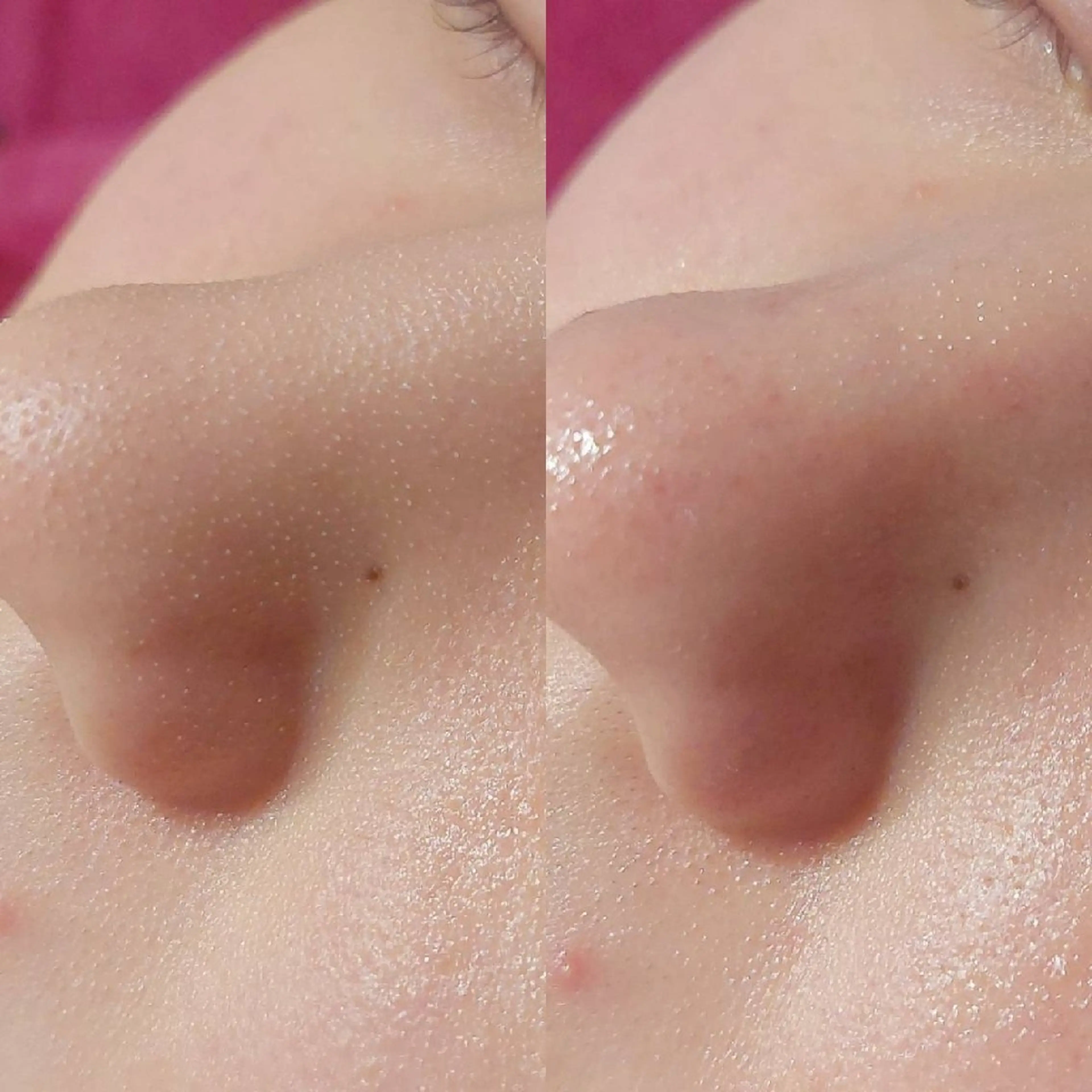 エステ MyFairLady miuのエステ・リラクイメージ