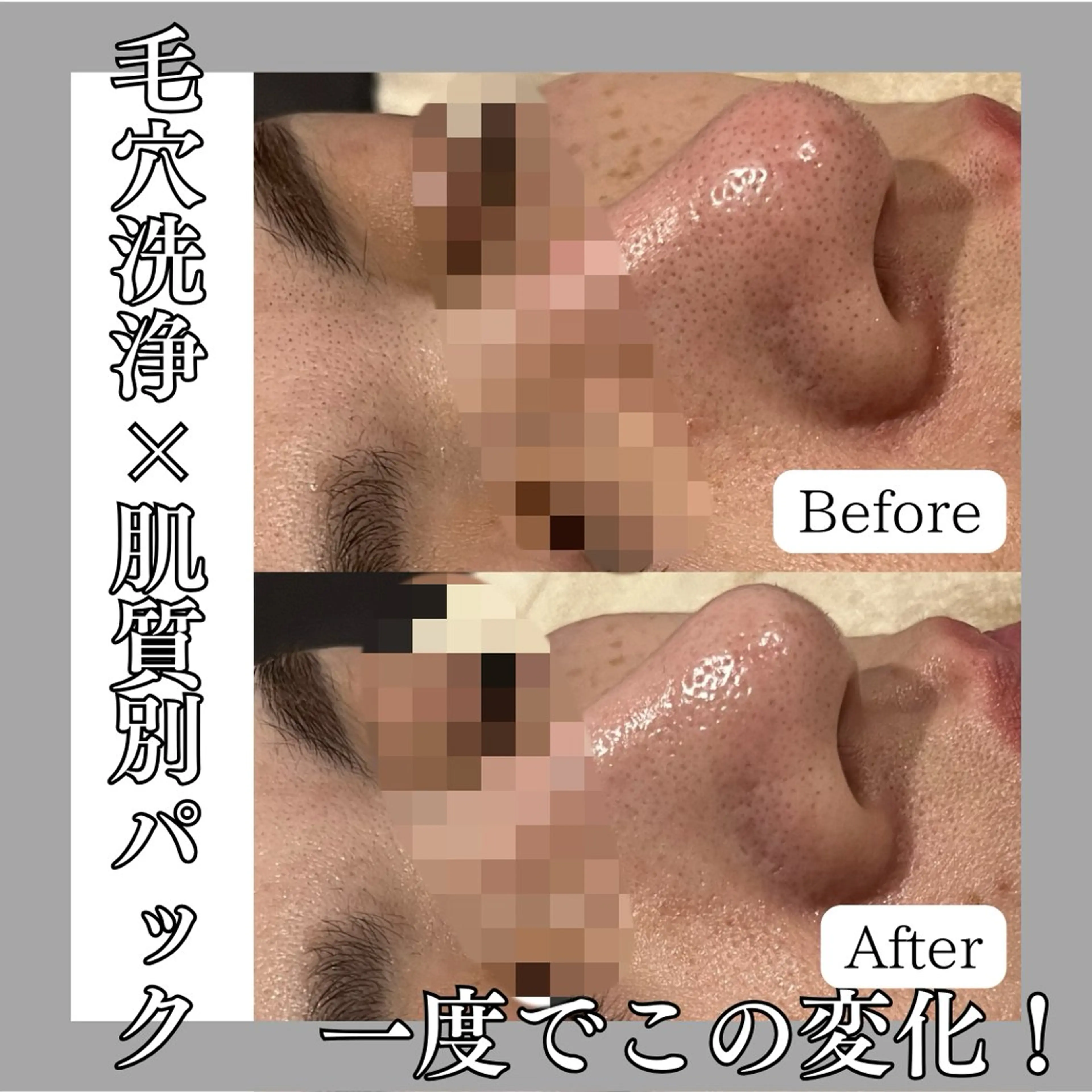 韓国肌管理専門店　White labo 梅田店所属・大西 亜季のエステ・リラクイメージ