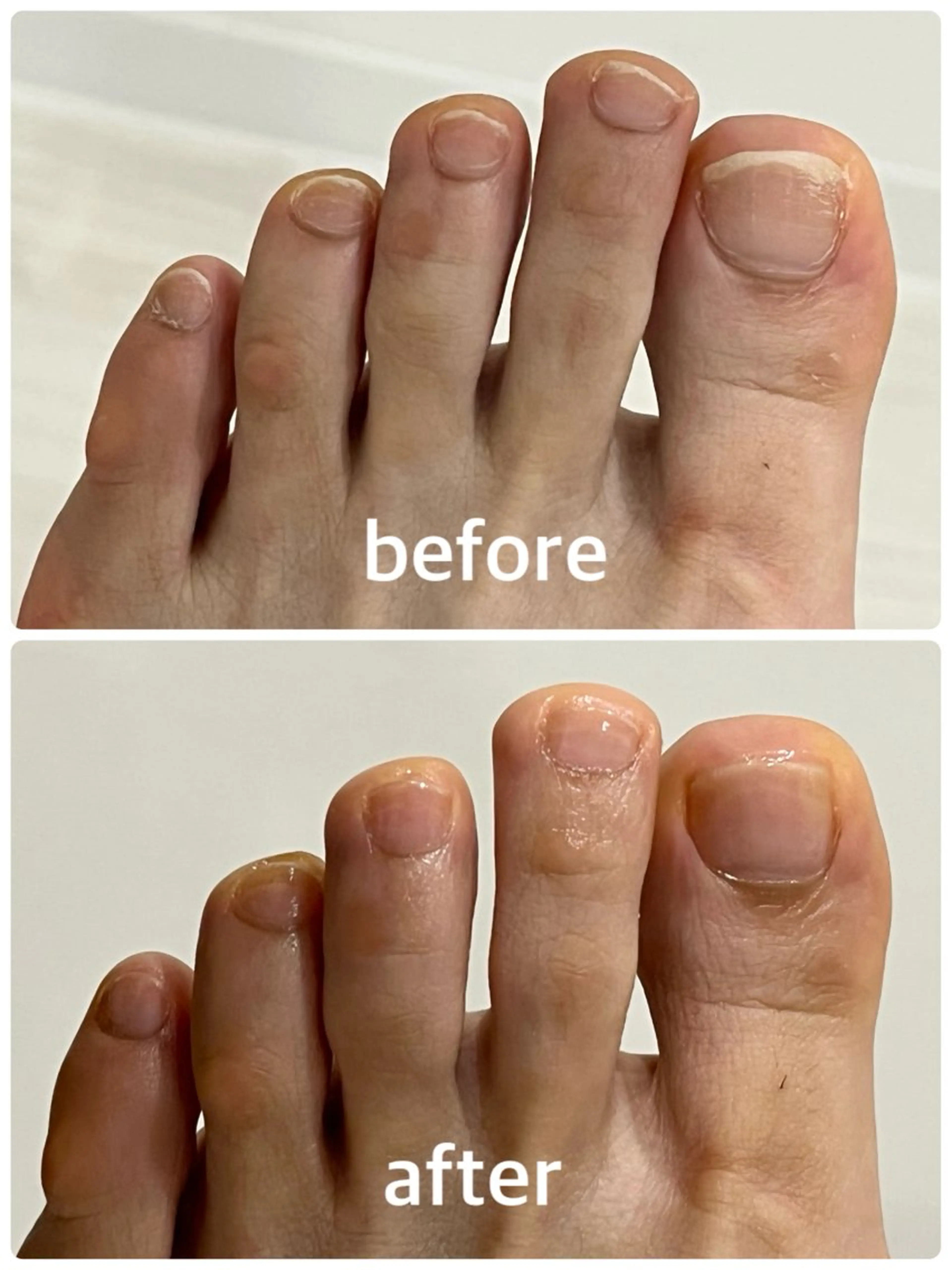 ネイル フットネイル フットネイル 足・爪トラブル専門店　foot grace所属・加藤 望のネイルデザイン