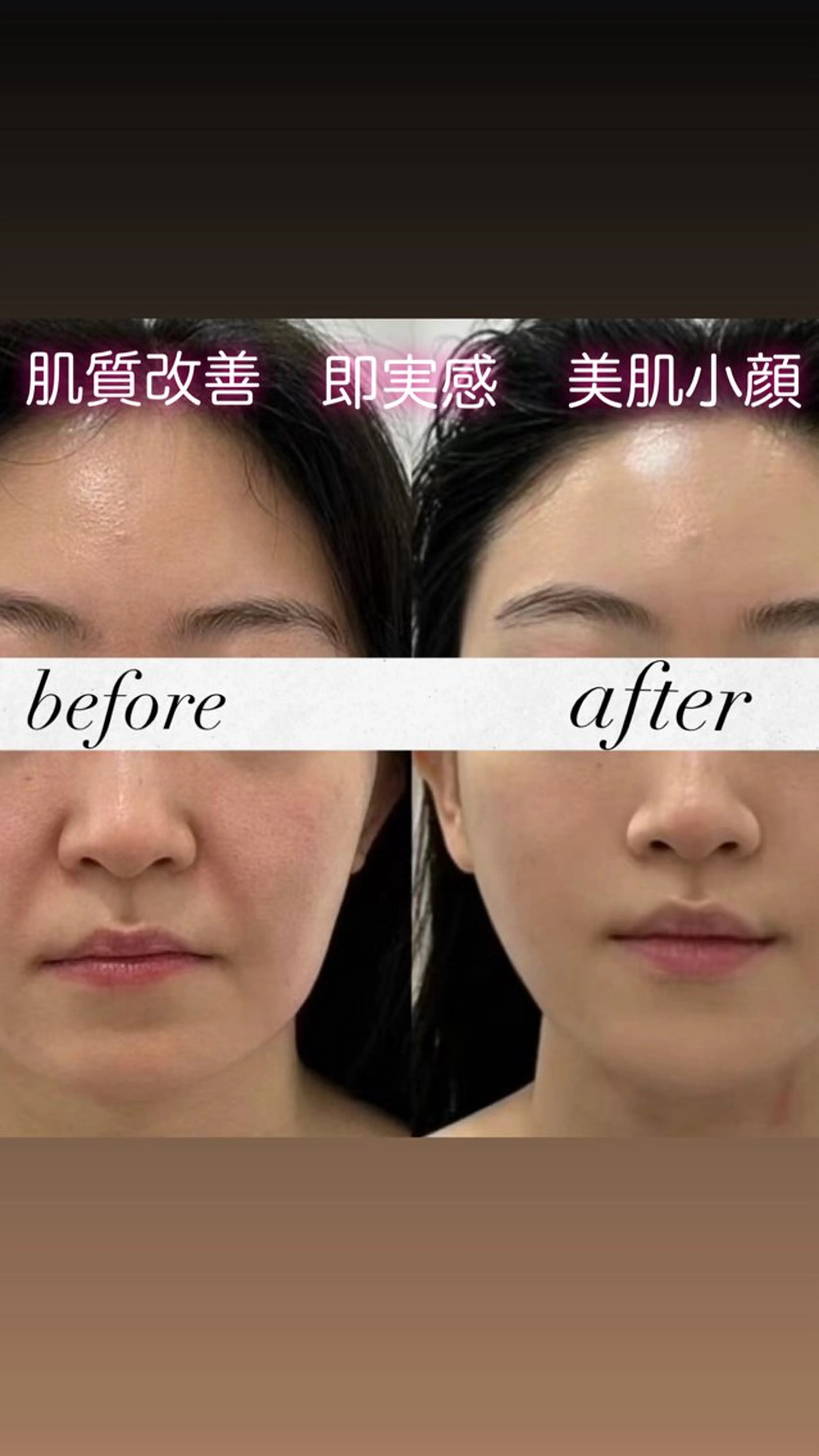 マツエク・マツパ エステ リラク 愛維美水光美肌専門店所属・愛維美水光美肌専門店 メンズレディースokのエステ・リラクイメージ