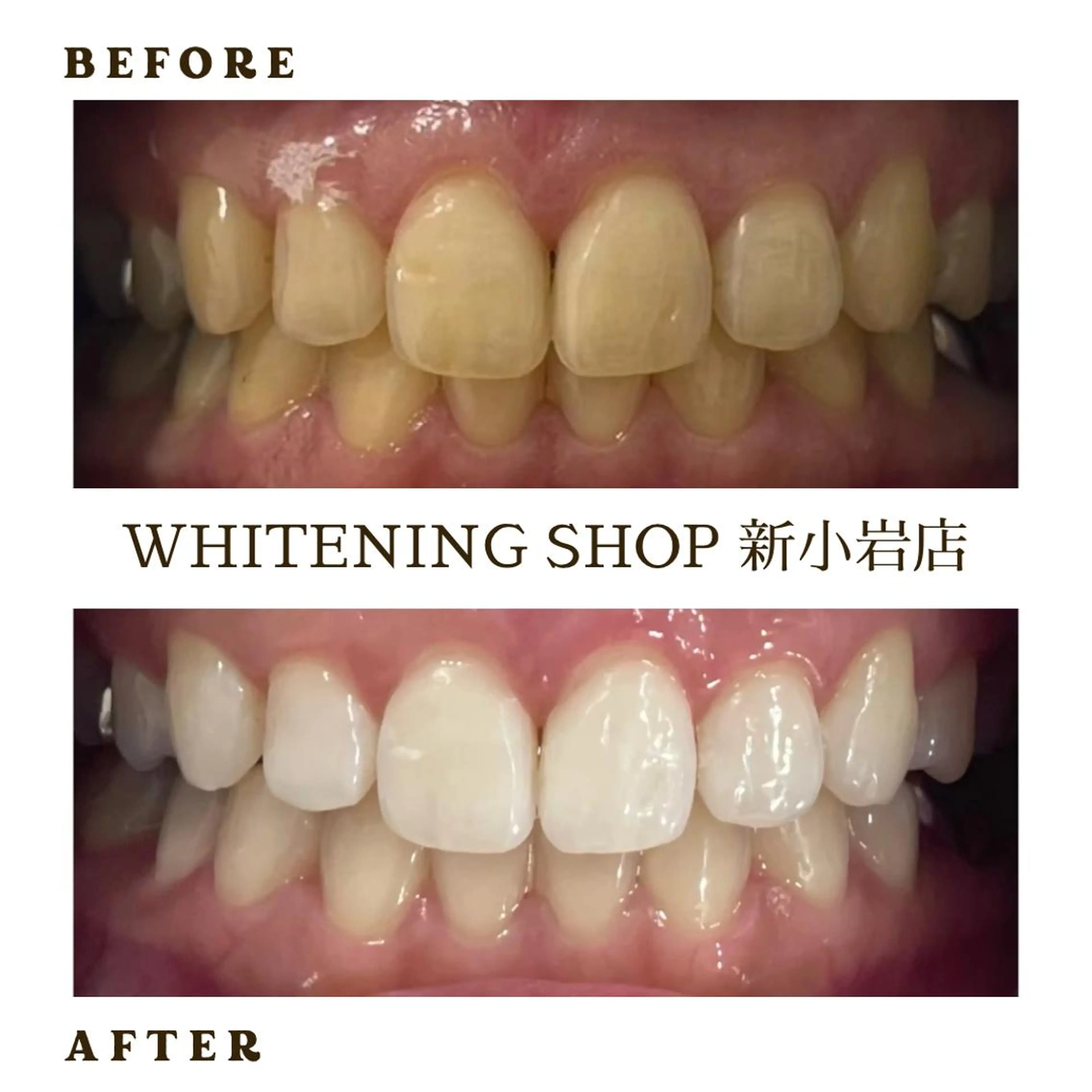 メンズ その他 ホワイトニング ショップ新小岩店のその他イメージ