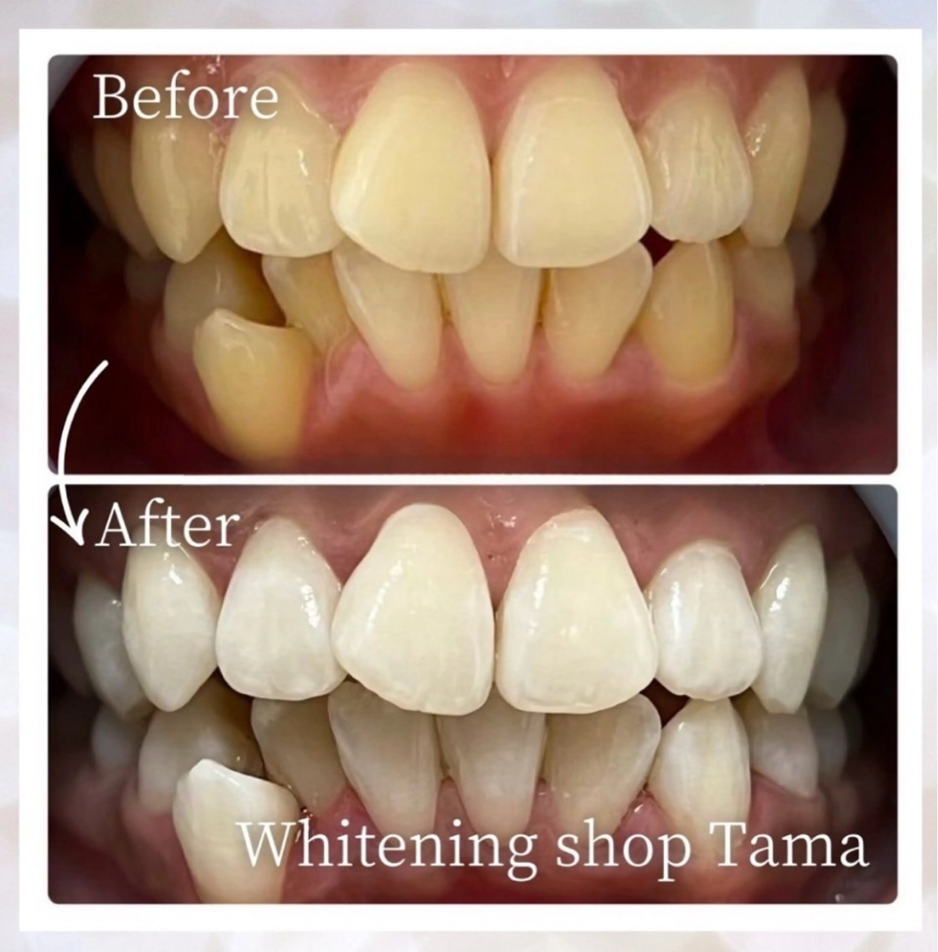 メンズ キッズ ホワイトニング ショップ多摩店のその他イメージ