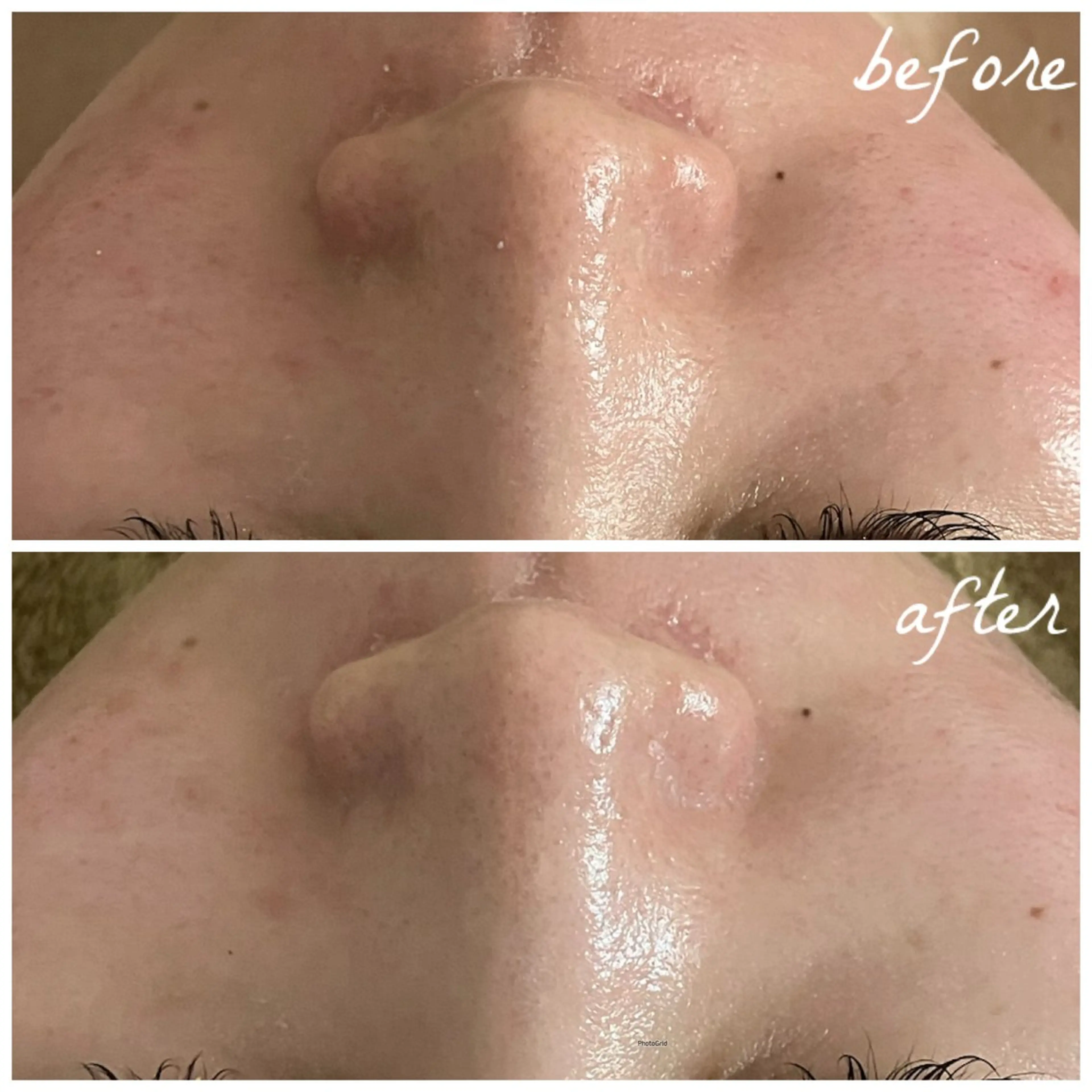 メンズ エステ メナード岐阜茜部 杉浦のエステ・リラクイメージ