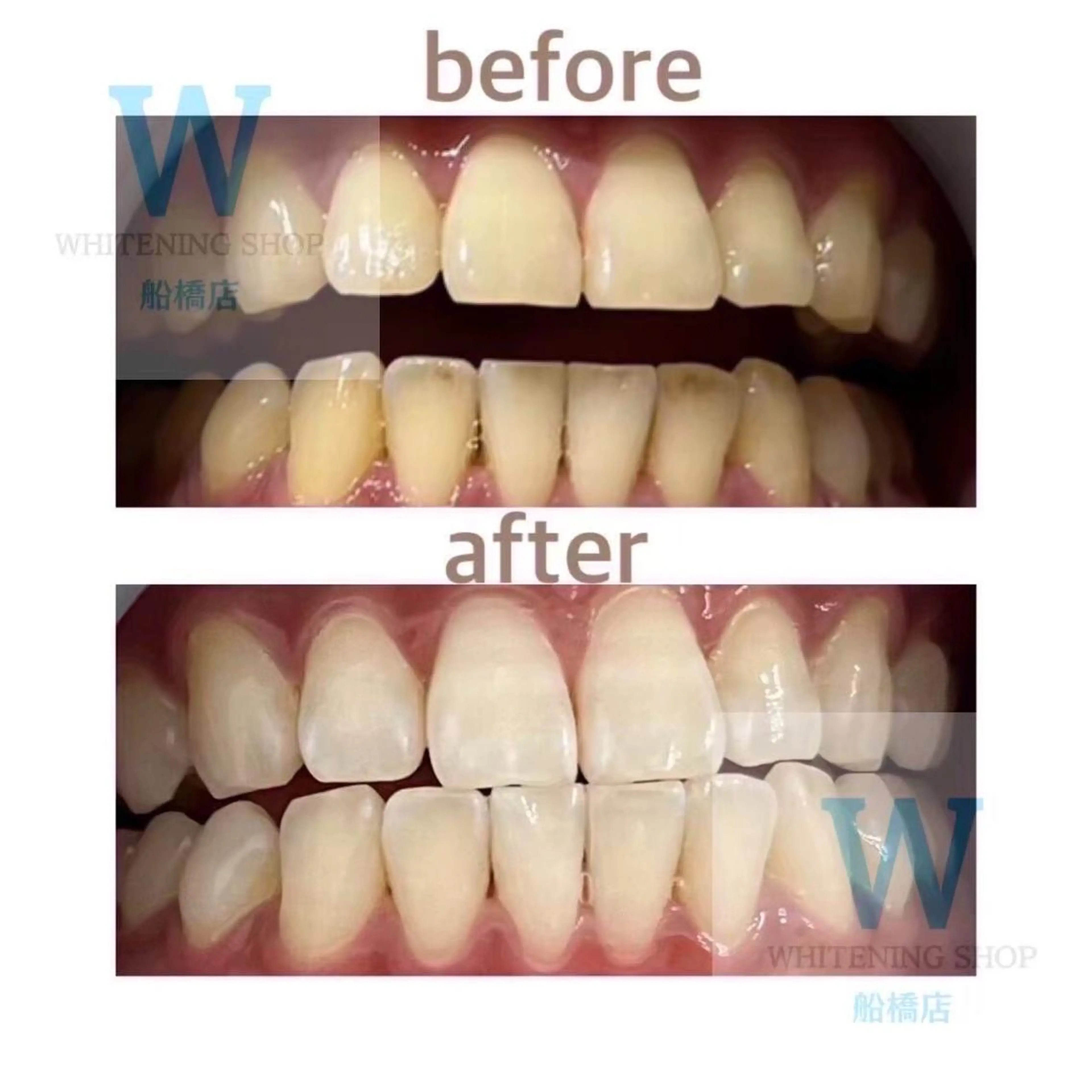 ホワイトニング ショップ船橋店🦷のエステ・リラクイメージ