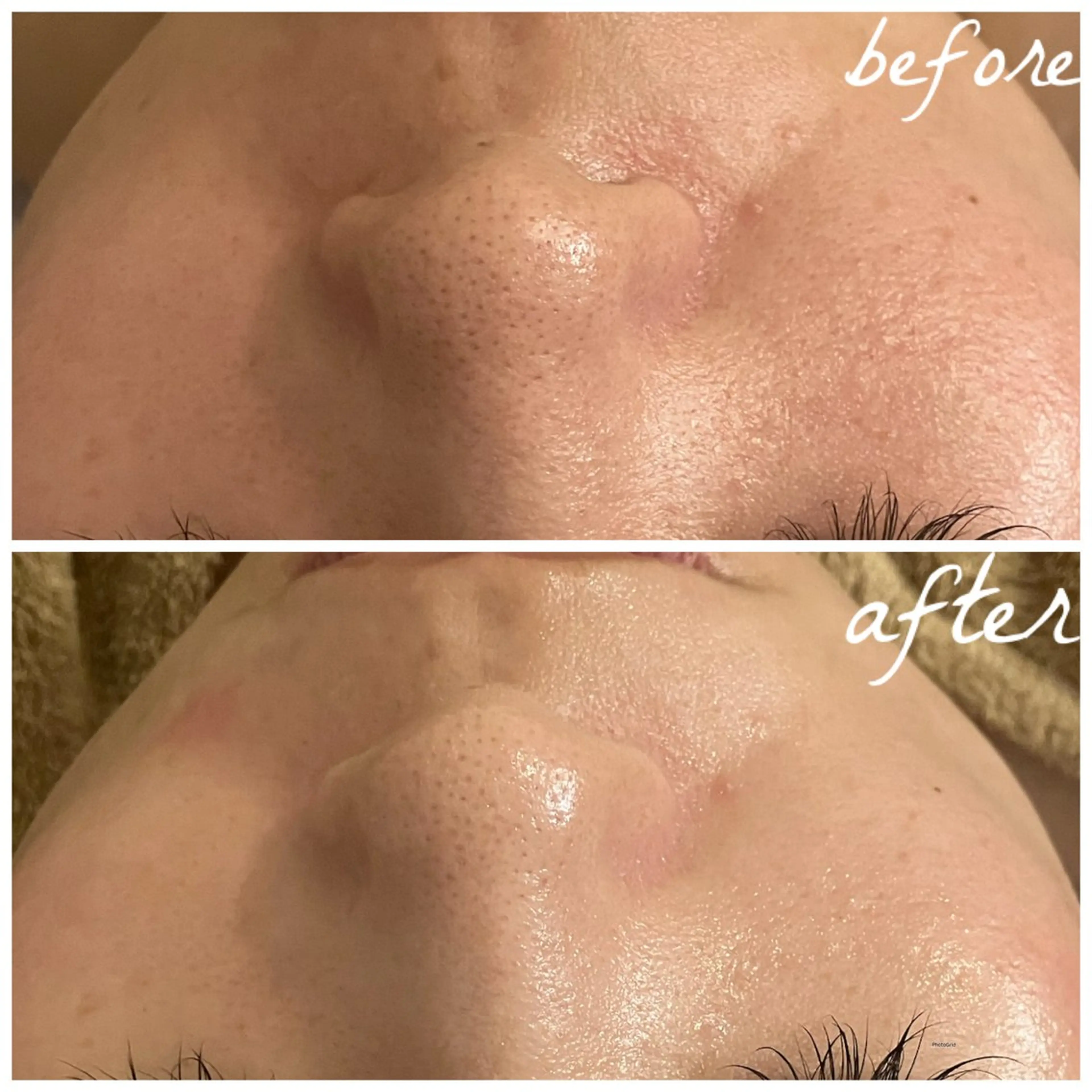 メンズ エステ メナード岐阜茜部 杉浦のエステ・リラクイメージ