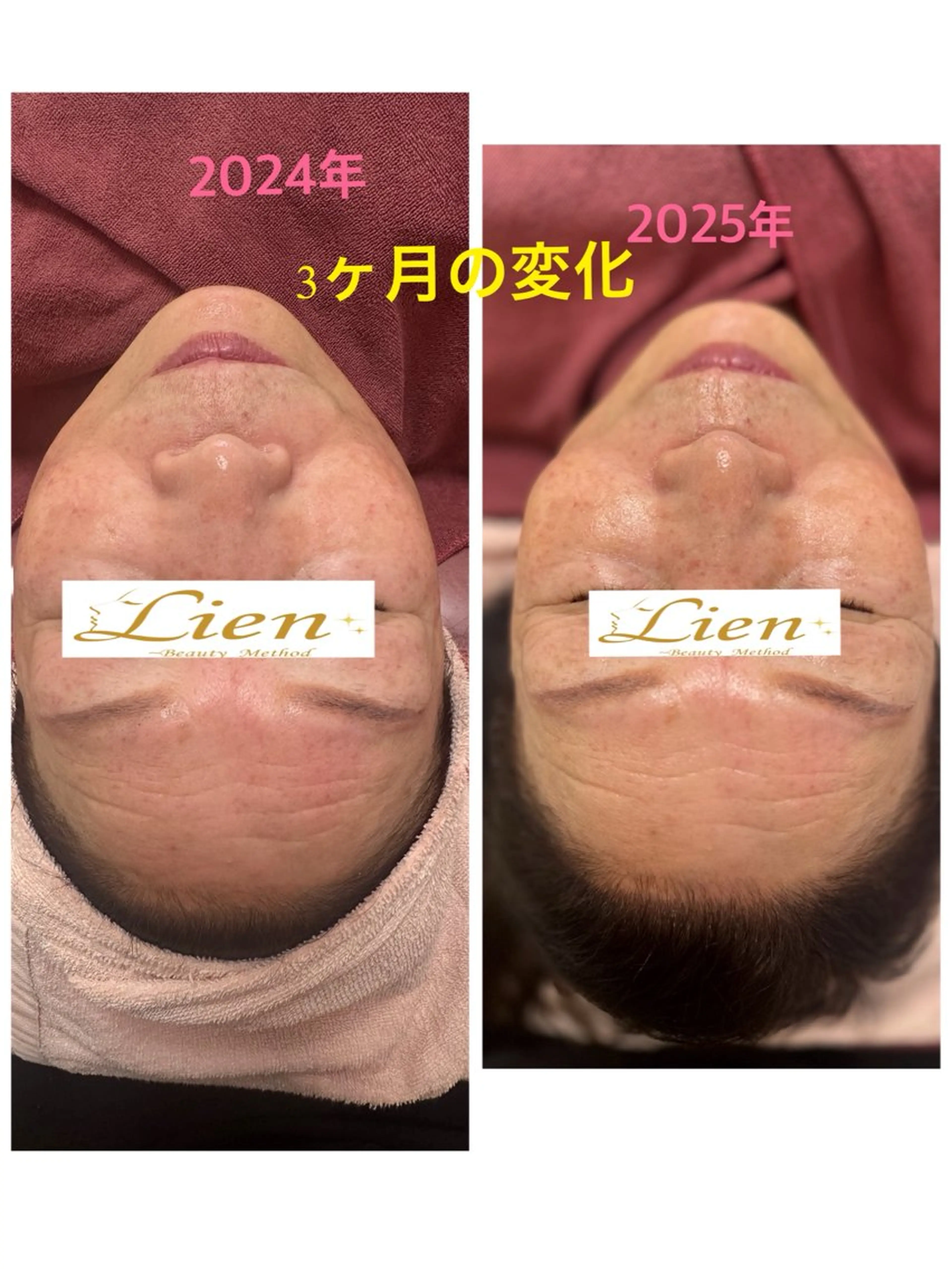 Lien オーナー 山口智嘉のエステ・リラクイメージ