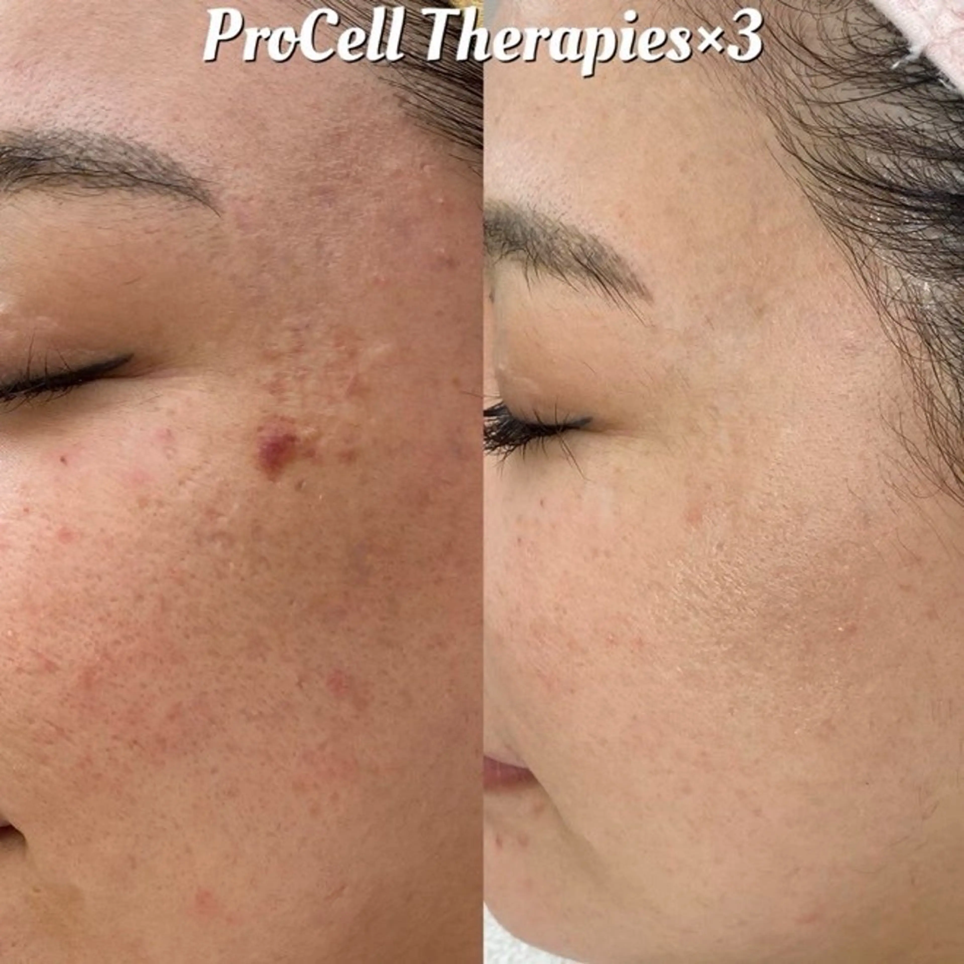 メンズ private salon Aola所属・プライベートサロン アオラのネイルデザイン