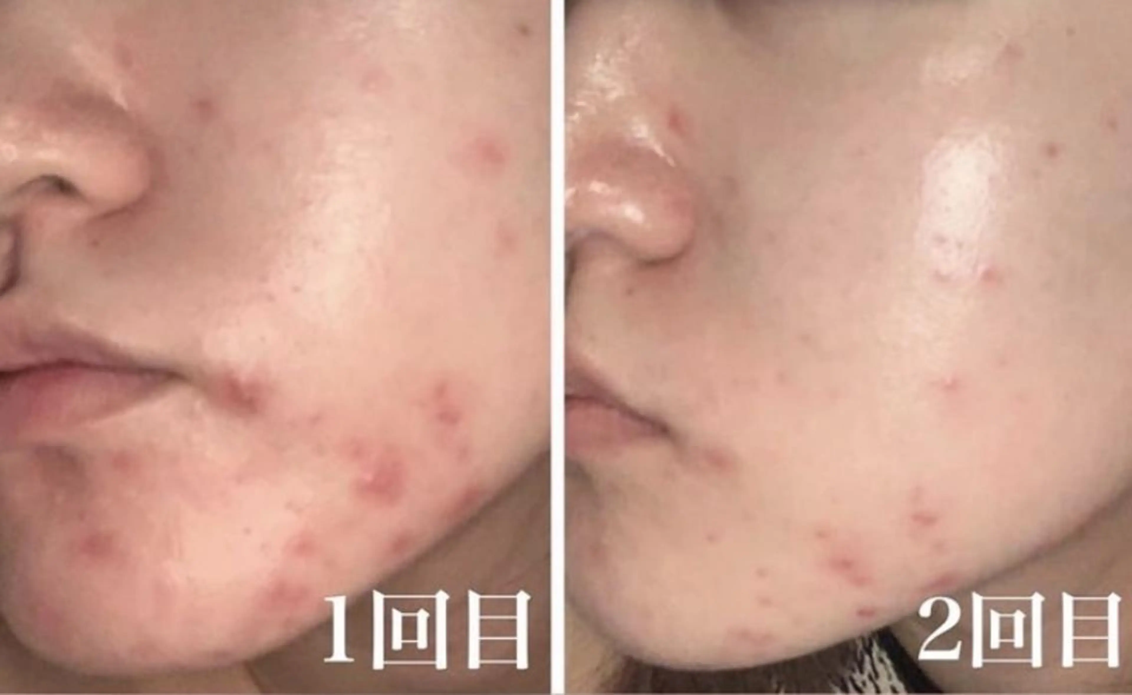 エステ EYE LASH LAPISのエステ・リラクイメージ