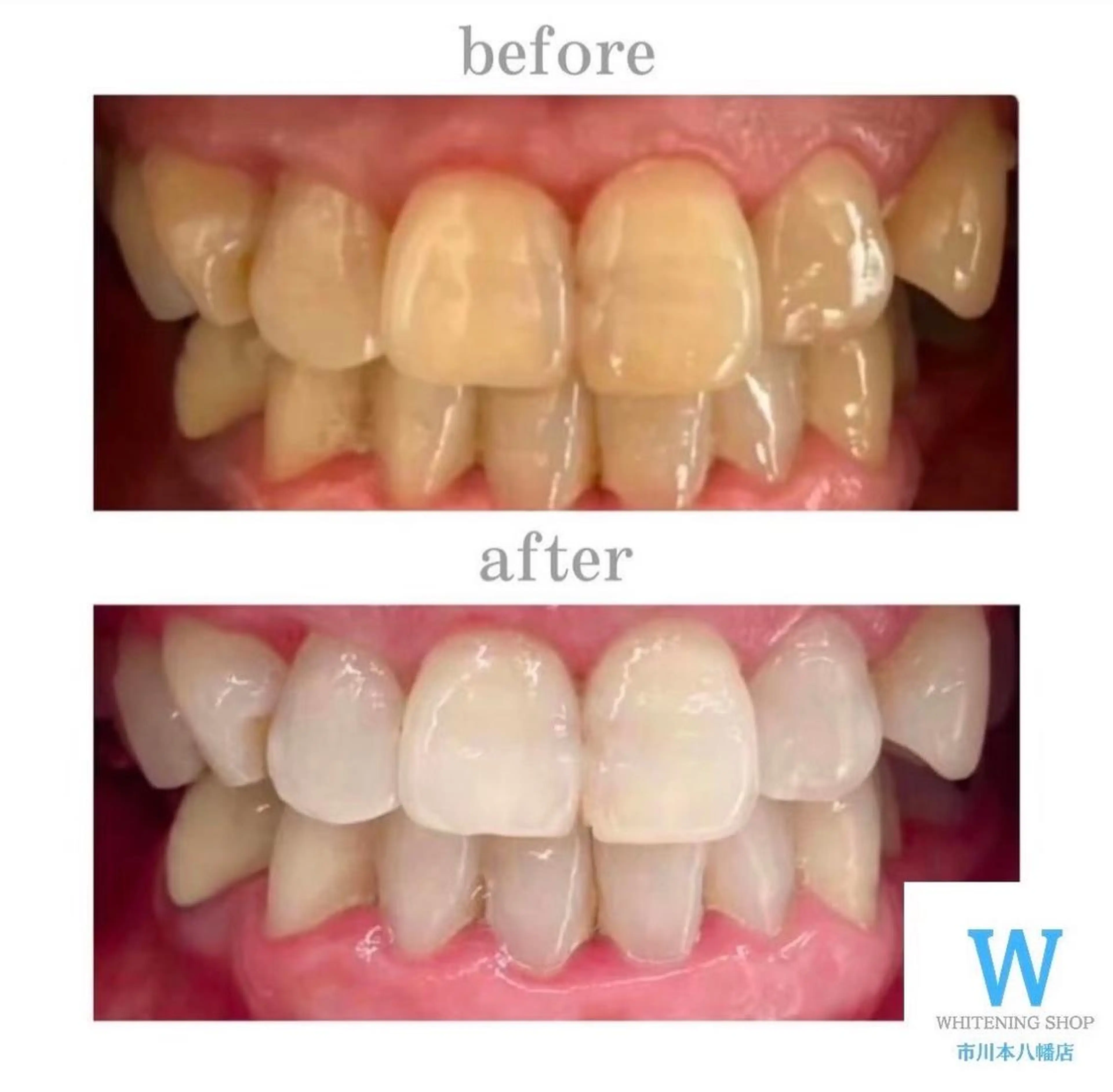 ホワイトニング ショップ本八幡店のエステ・リラクイメージ