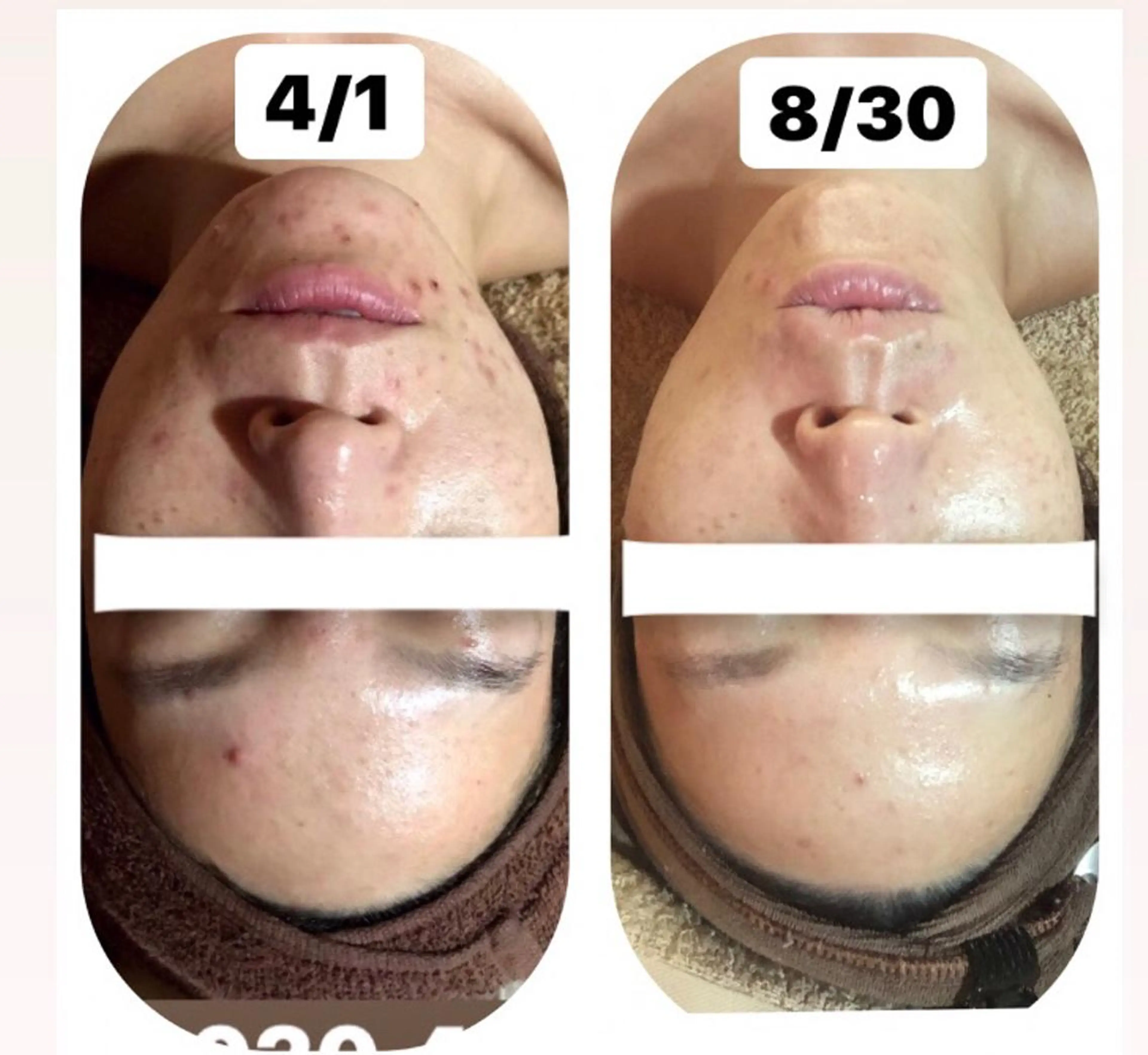 【足圧】鬼👹リンパ 身体整うサロンのエステ・リラクイメージ