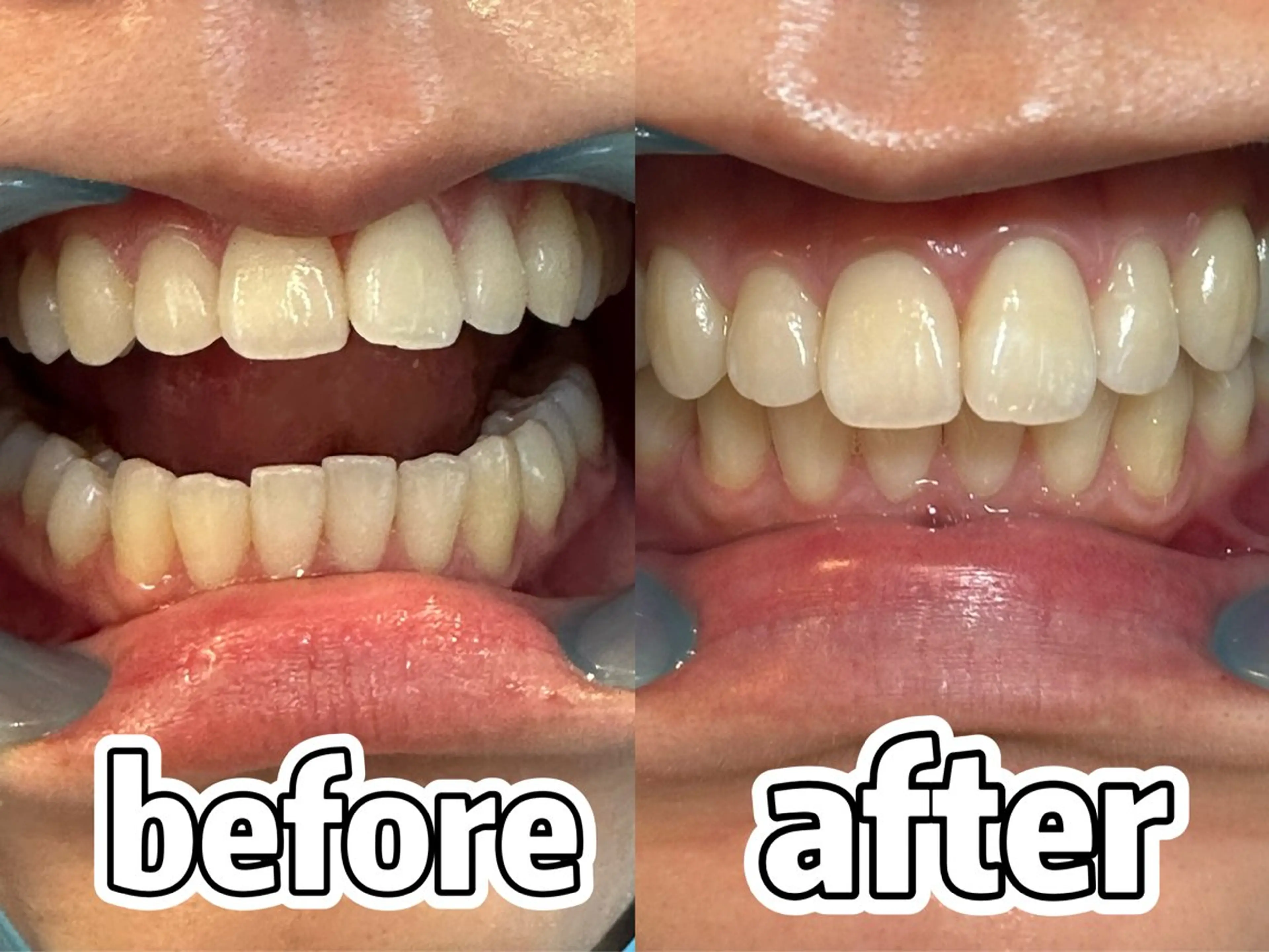 その他 浮腫|肩こり|張り 日々の疲れを解消⭐️のエステ・リラクイメージ