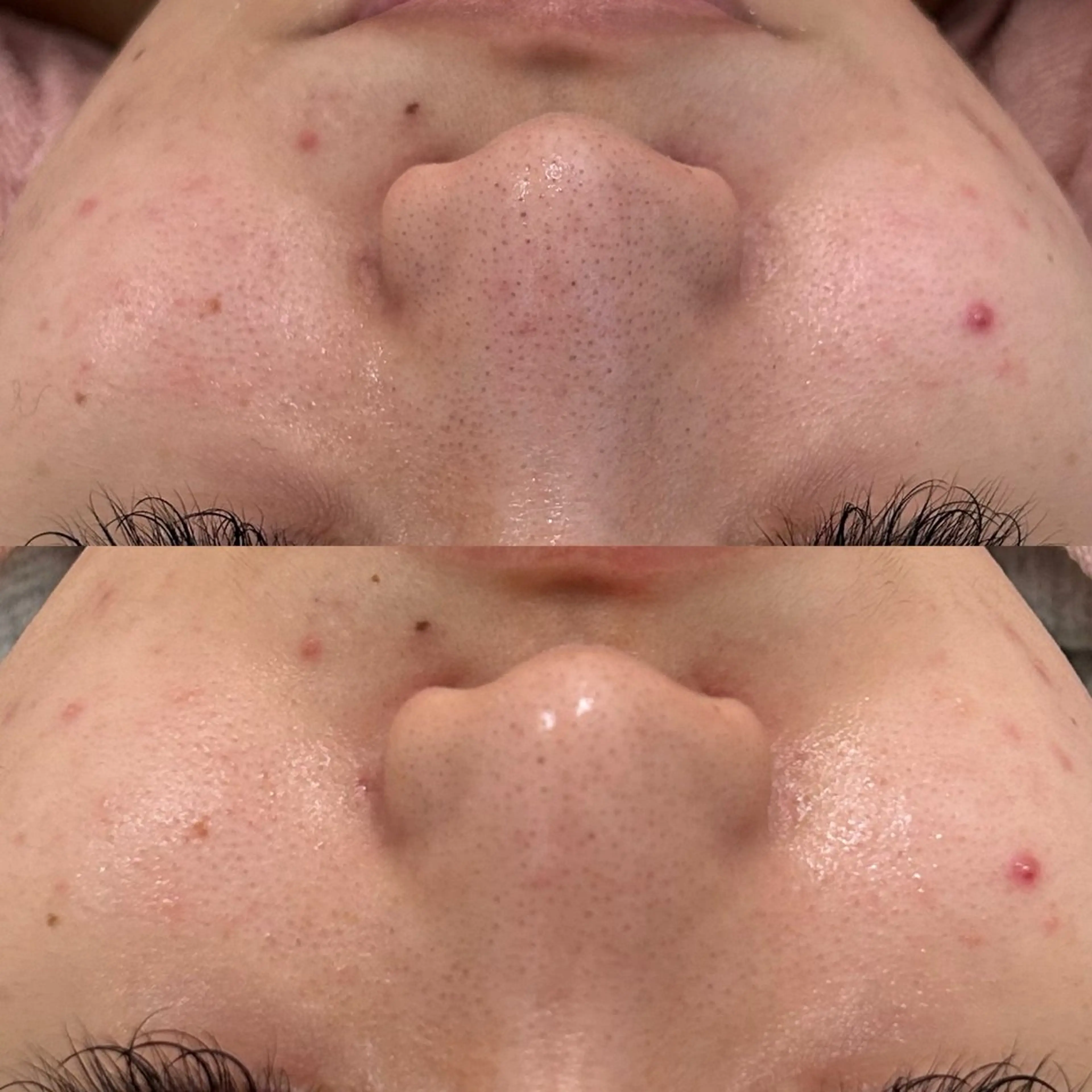 〈etre〉トータルビューティーサロン所属・etre - 韓国肌管理 -のエステ・リラクイメージ