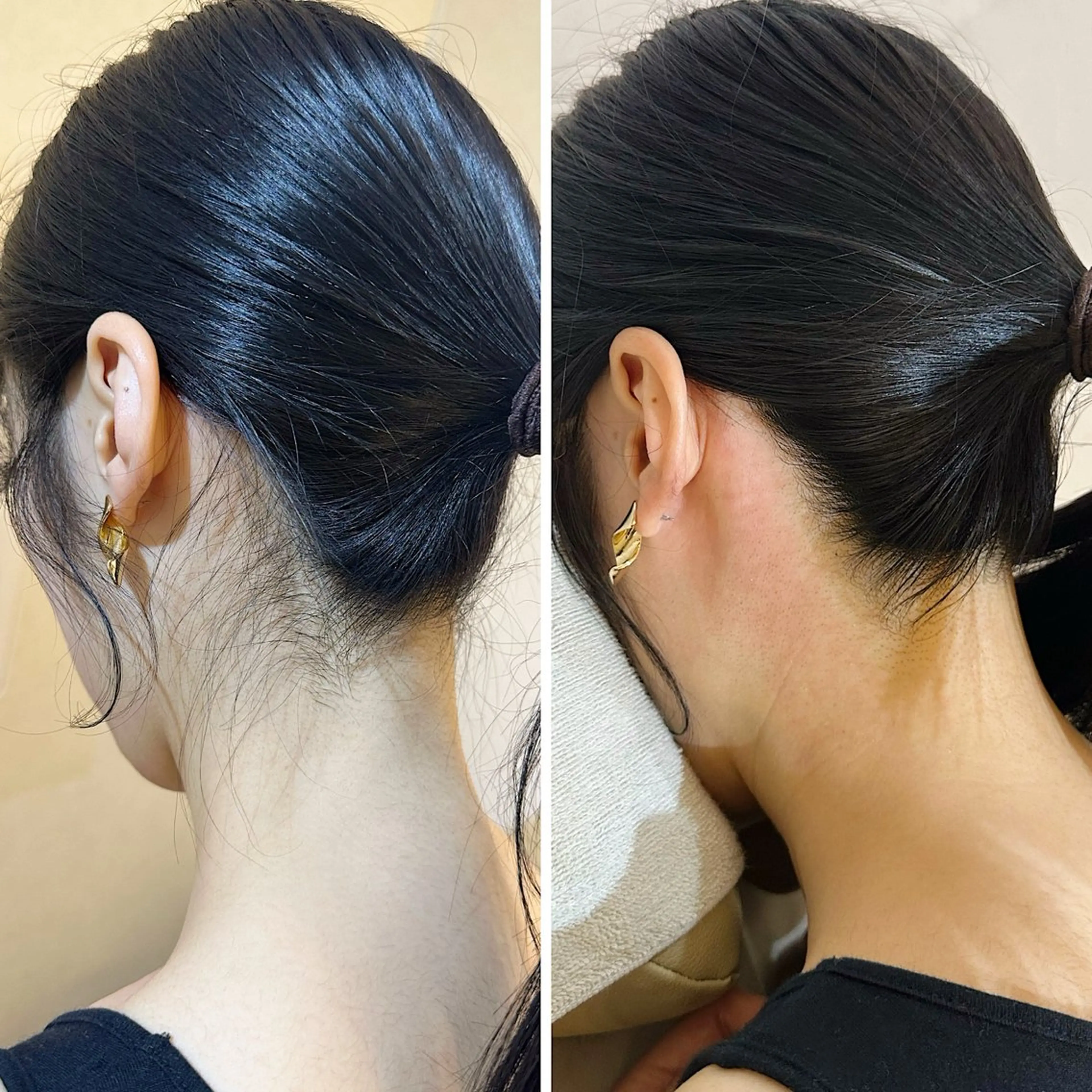 脱毛 うなじ脱毛/美肌脱毛 LABELのエステ・リラクイメージ