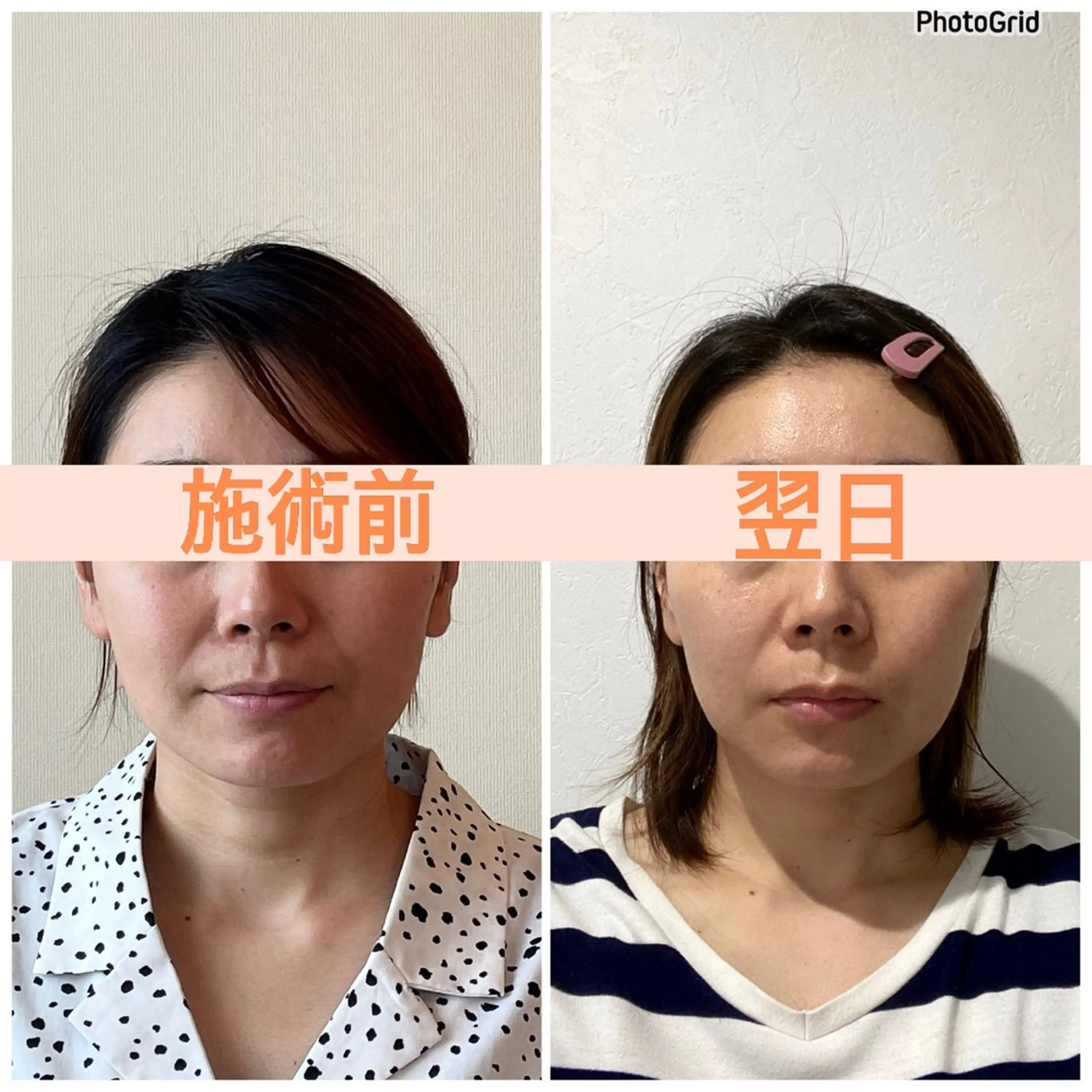 小顔矯正サロン　ReFace Fusae（リフェイスフサエ）所属・小顔矯正サロン リフェイスフサエのエステ・リラクイメージ