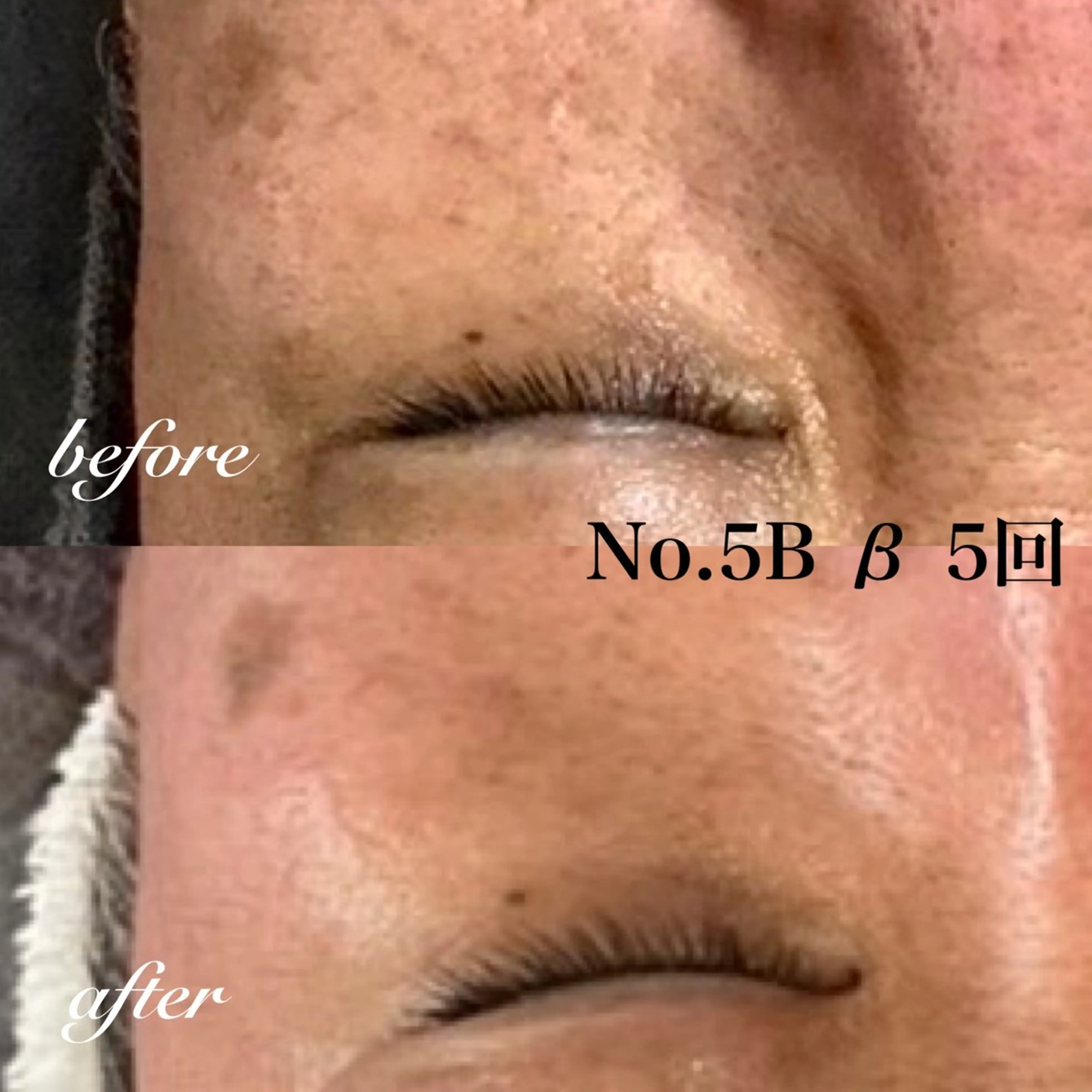 オールハンド フェイシャルのエステ・リラクイメージ