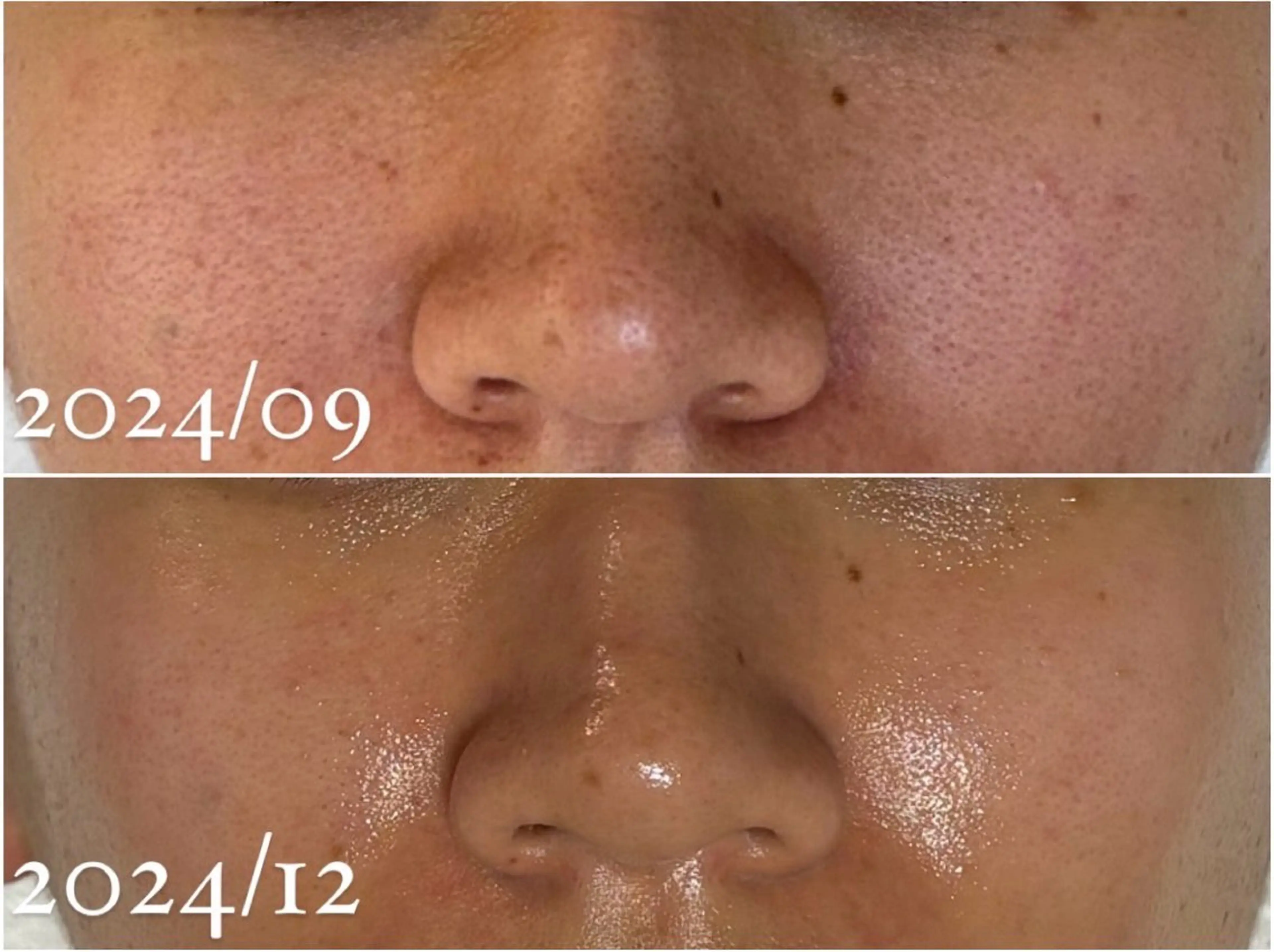 田中For..天王寺 肌質改善/よもぎ蒸しのエステ・リラクイメージ