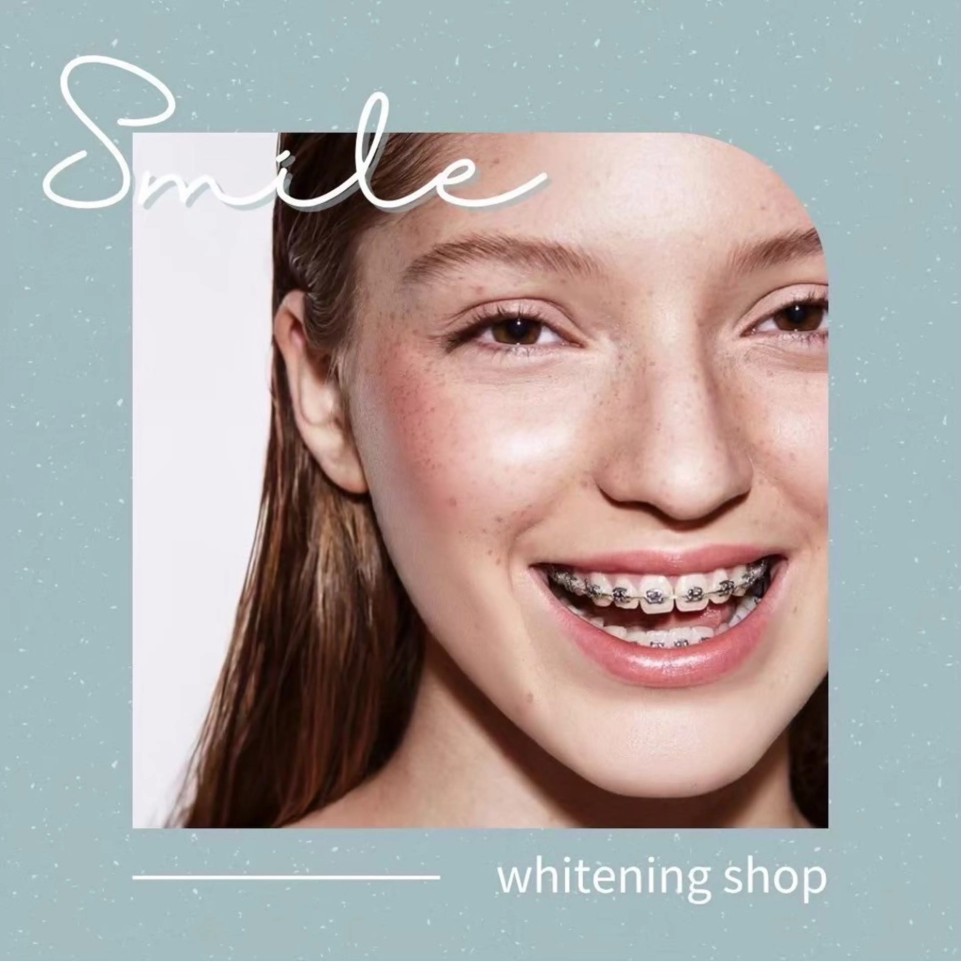 その他 ホワイトニングショップ伊丹店所属・ホワイトニング ショップ伊丹店のその他イメージ