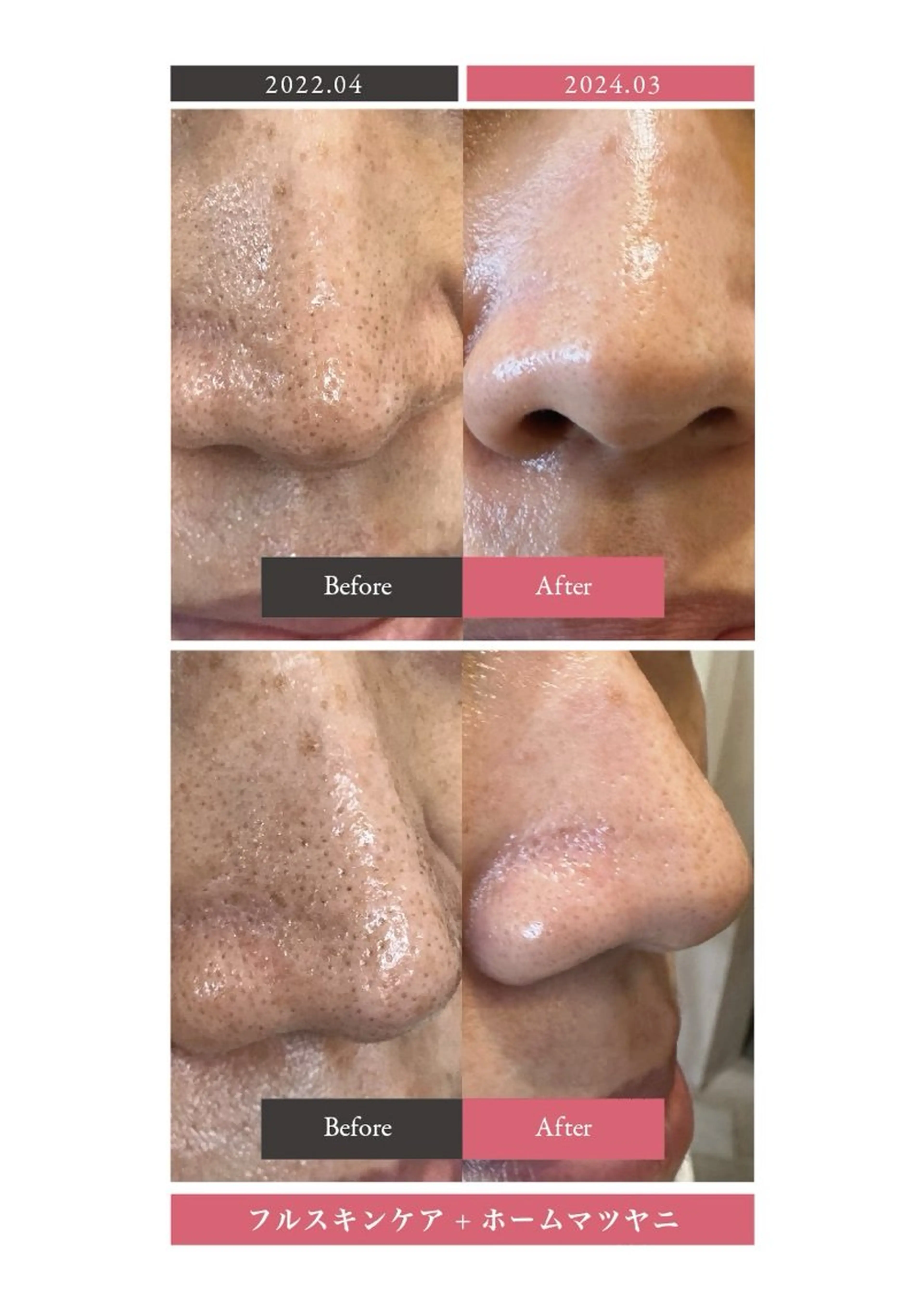 エステ リラク nouvelle  plume所属・ヌーベル プリュムのエステ・リラクイメージ