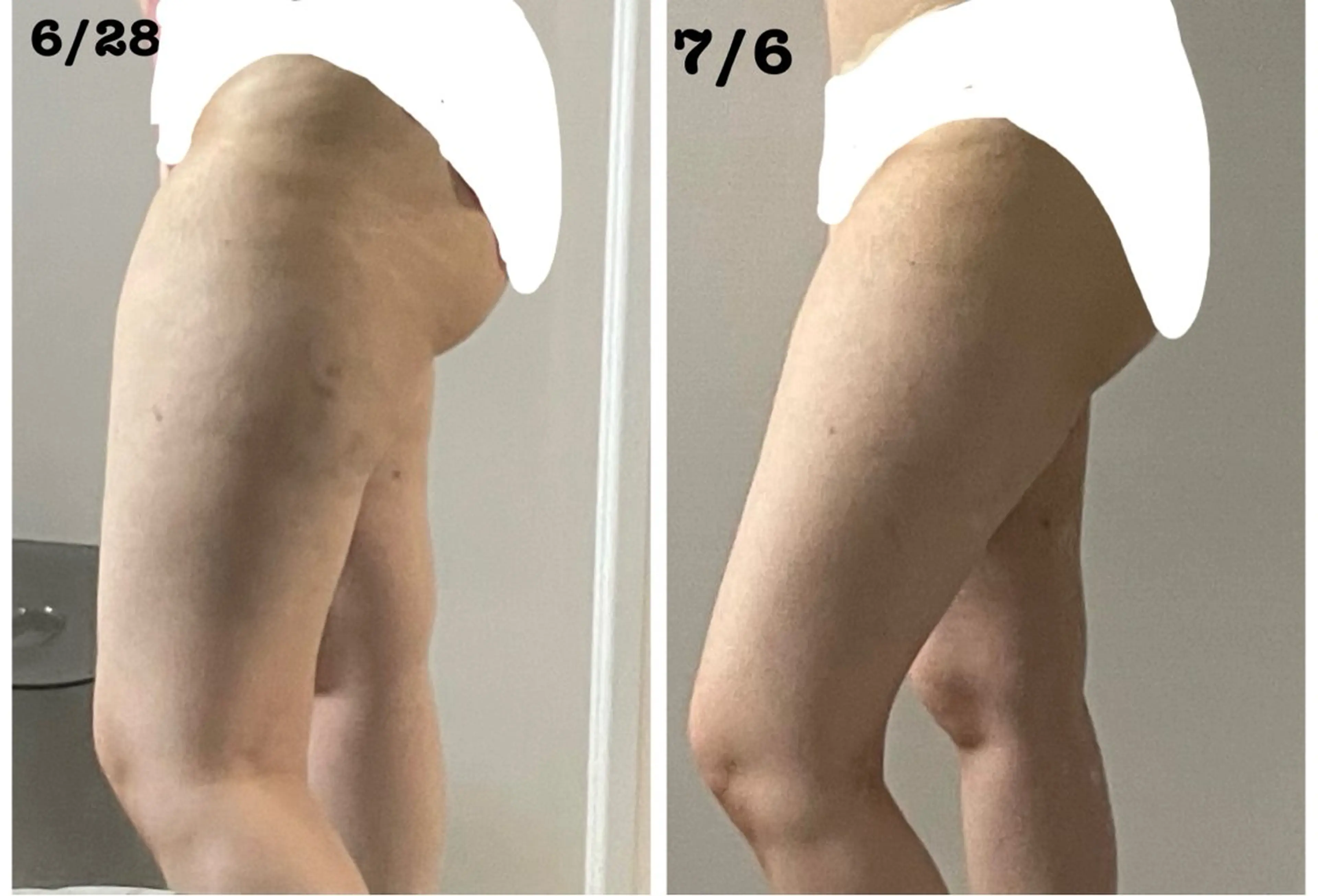 Le Cherien所属・姫路/肌管理/脱毛 Le Cherienのその他イメージ